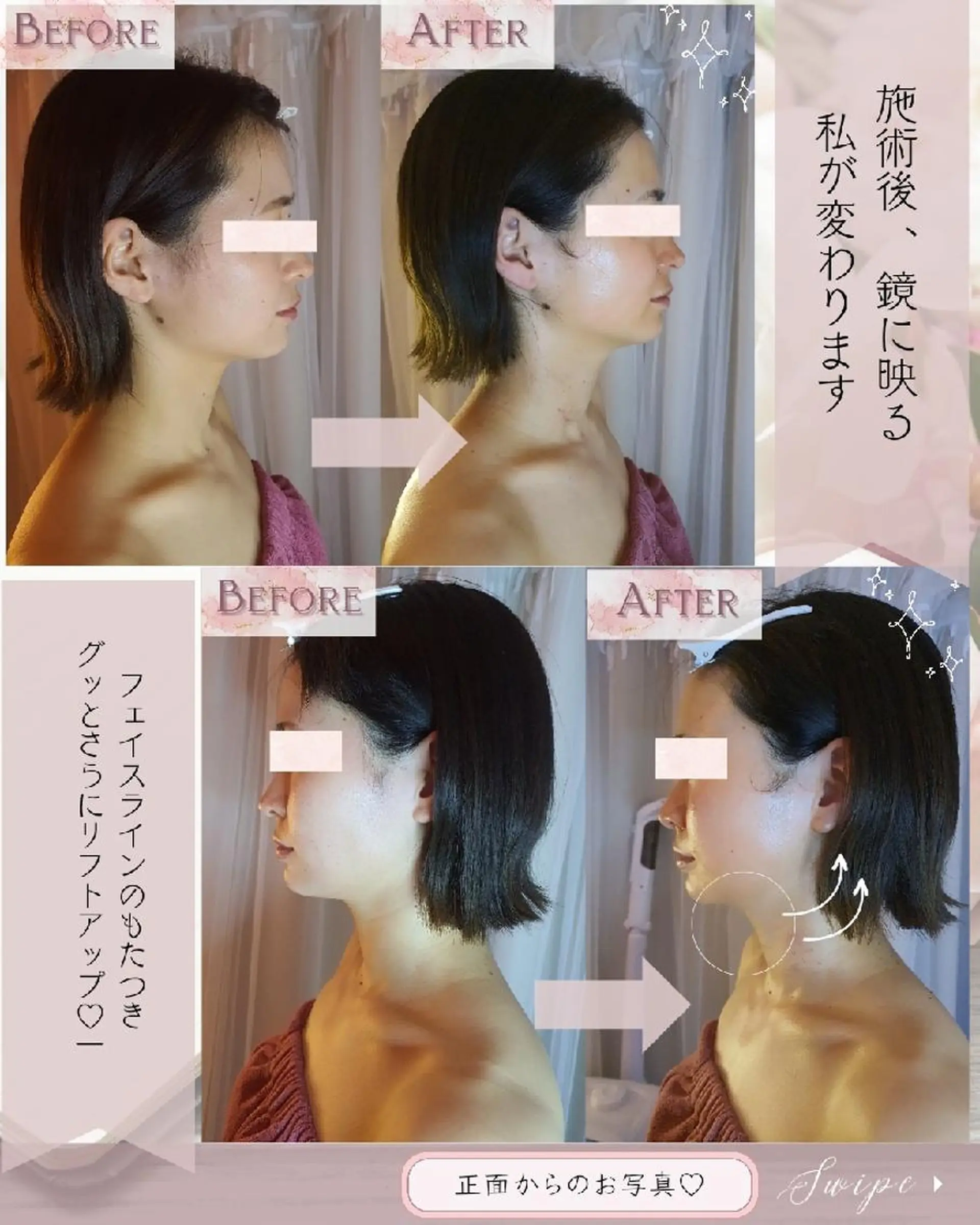 痩身ハーブピーリング 筋膜リリース☆B&Hのエステ・リラクイメージ