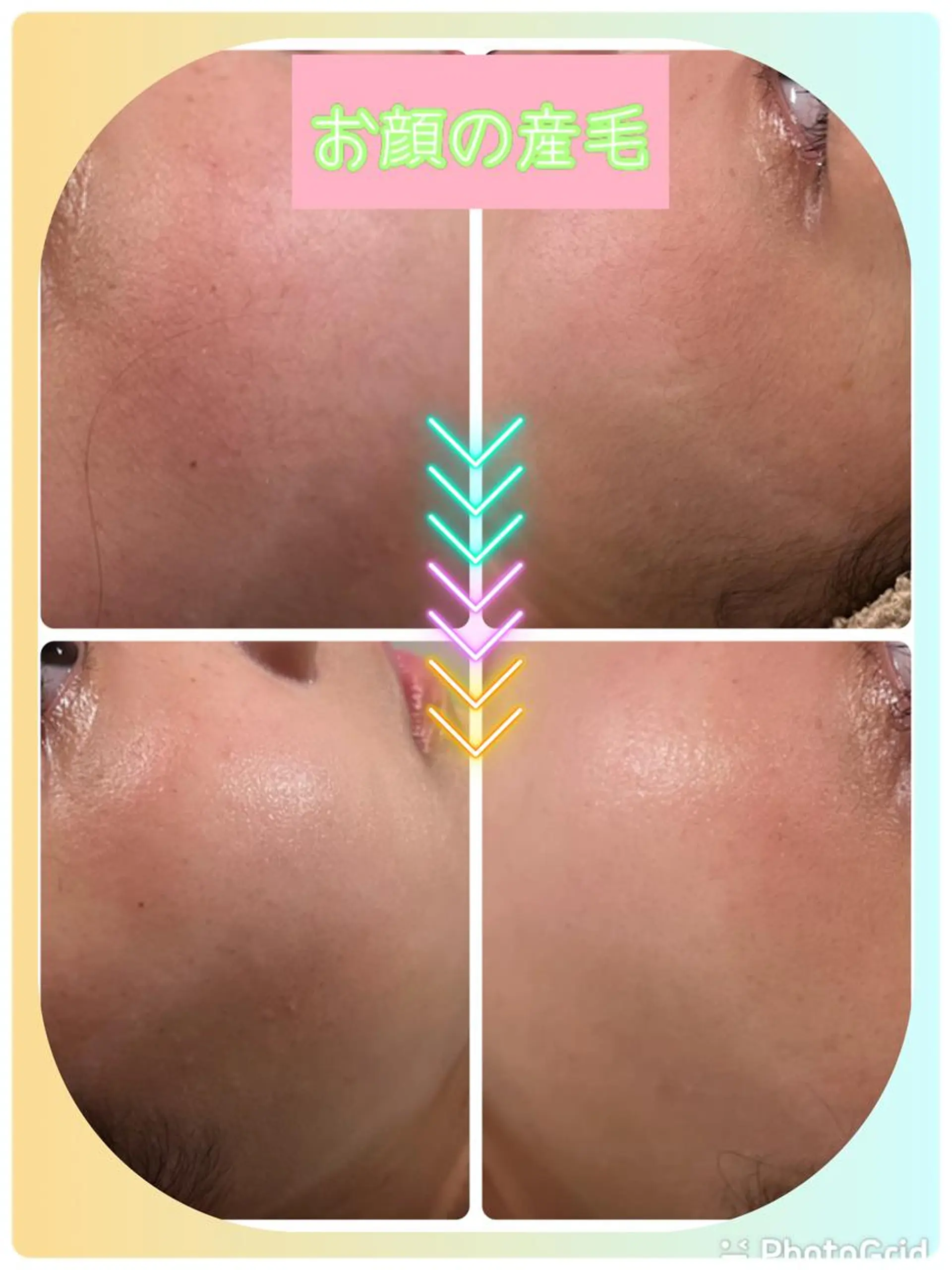 脱毛 LUKE （ルーク）のエステ・リラクイメージ