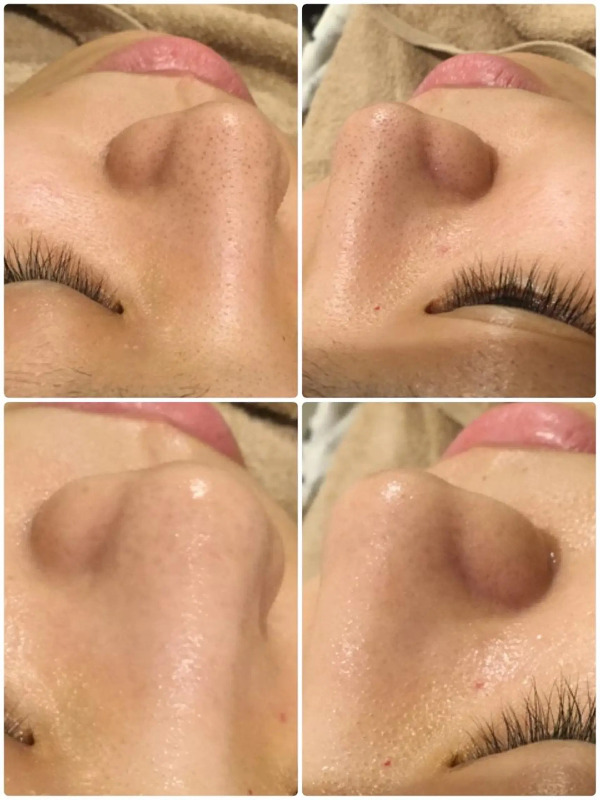 エステ 【リベルハーブピーリング認定店】敏感肌・美白脱毛専門店Dione立川店所属・Dione 立川店のエステ・リラクイメージ