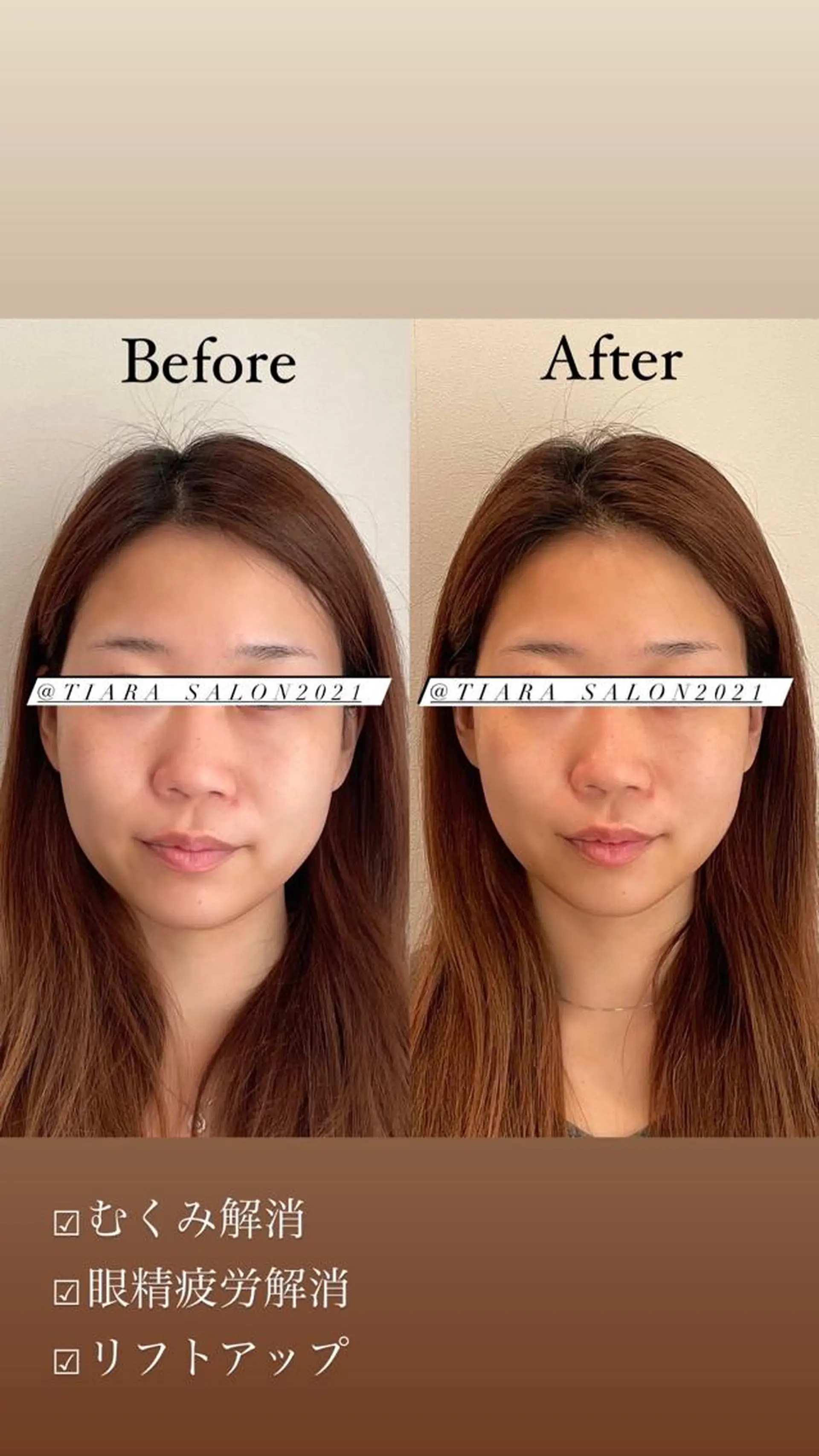 美容鍼灸サロン　TIARA所属・鍼灸サロン TIARA　美容鍼のエステ・リラクイメージ