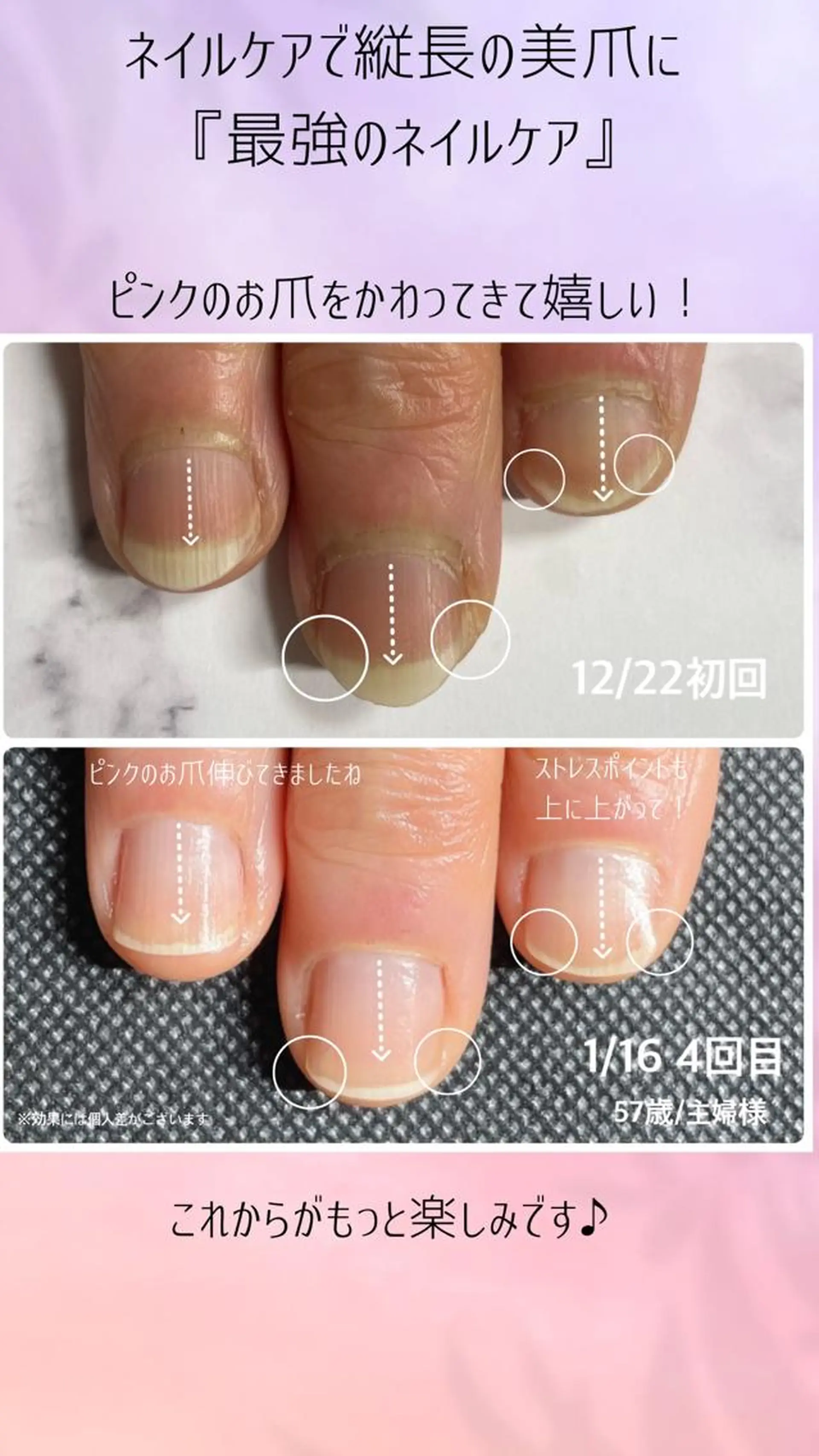 ネイル 奥園 良恵のネイルデザイン