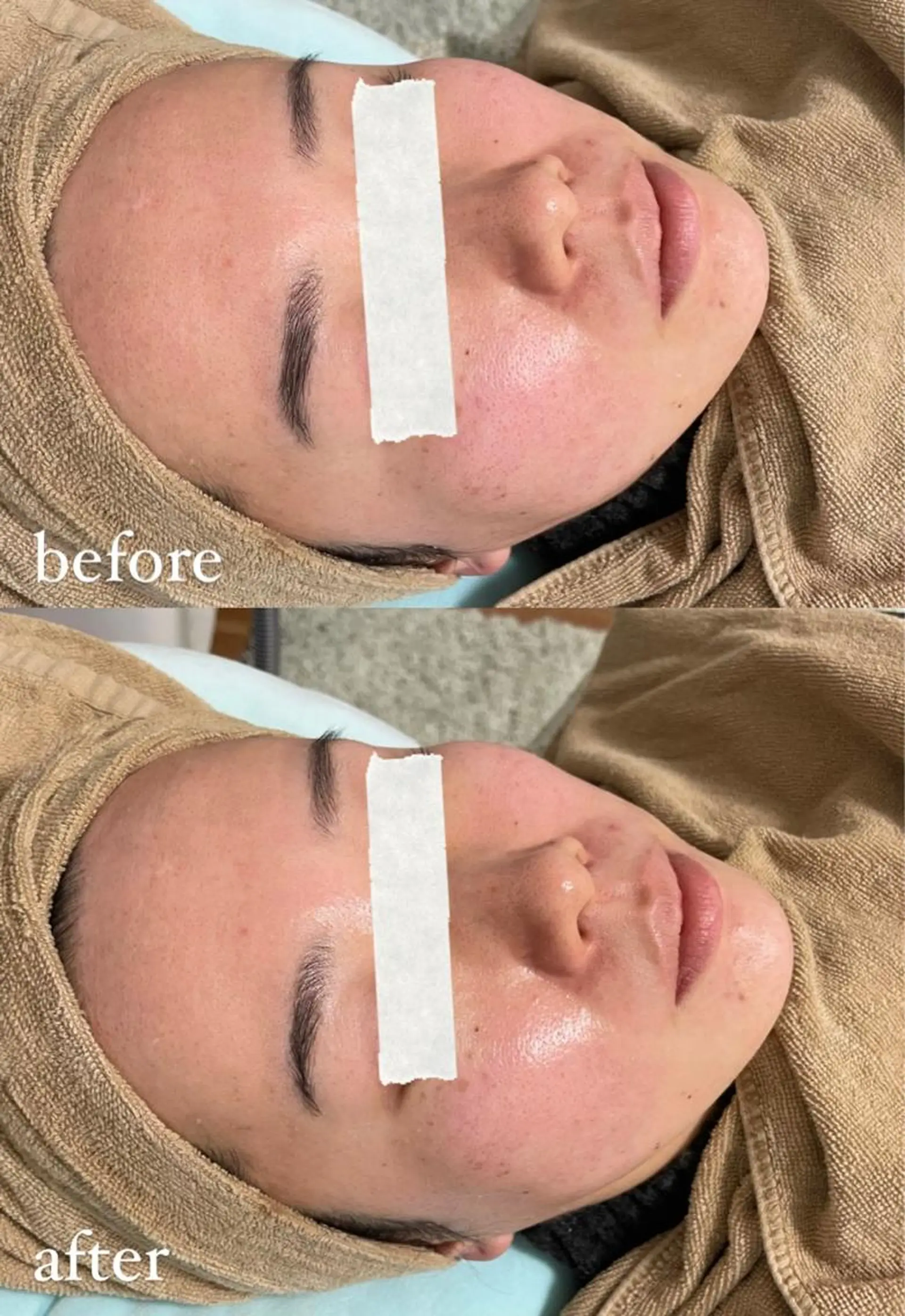 脱毛 エステサロン Mi-mi.iのエステ・リラクイメージ