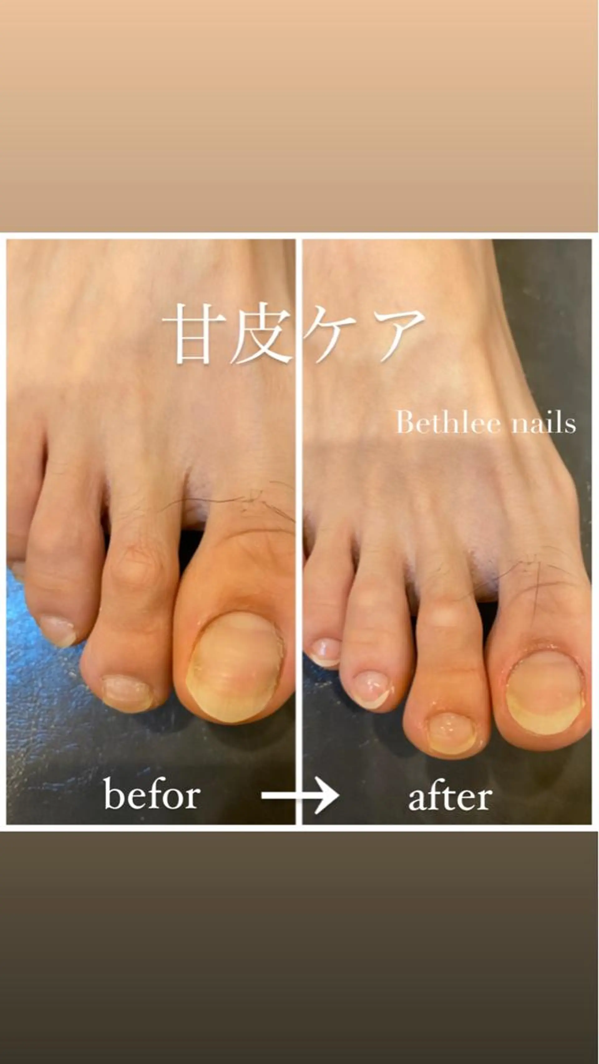 ネイル フットネイル Bethlee nailsのネイルデザイン