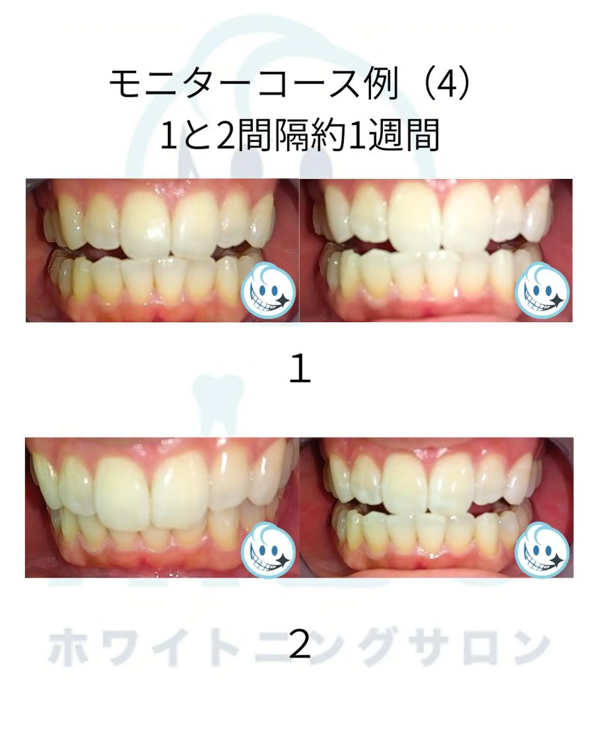セミロング カラー その他 ホワイトニングサロン nico西葛西店のその他イメージ