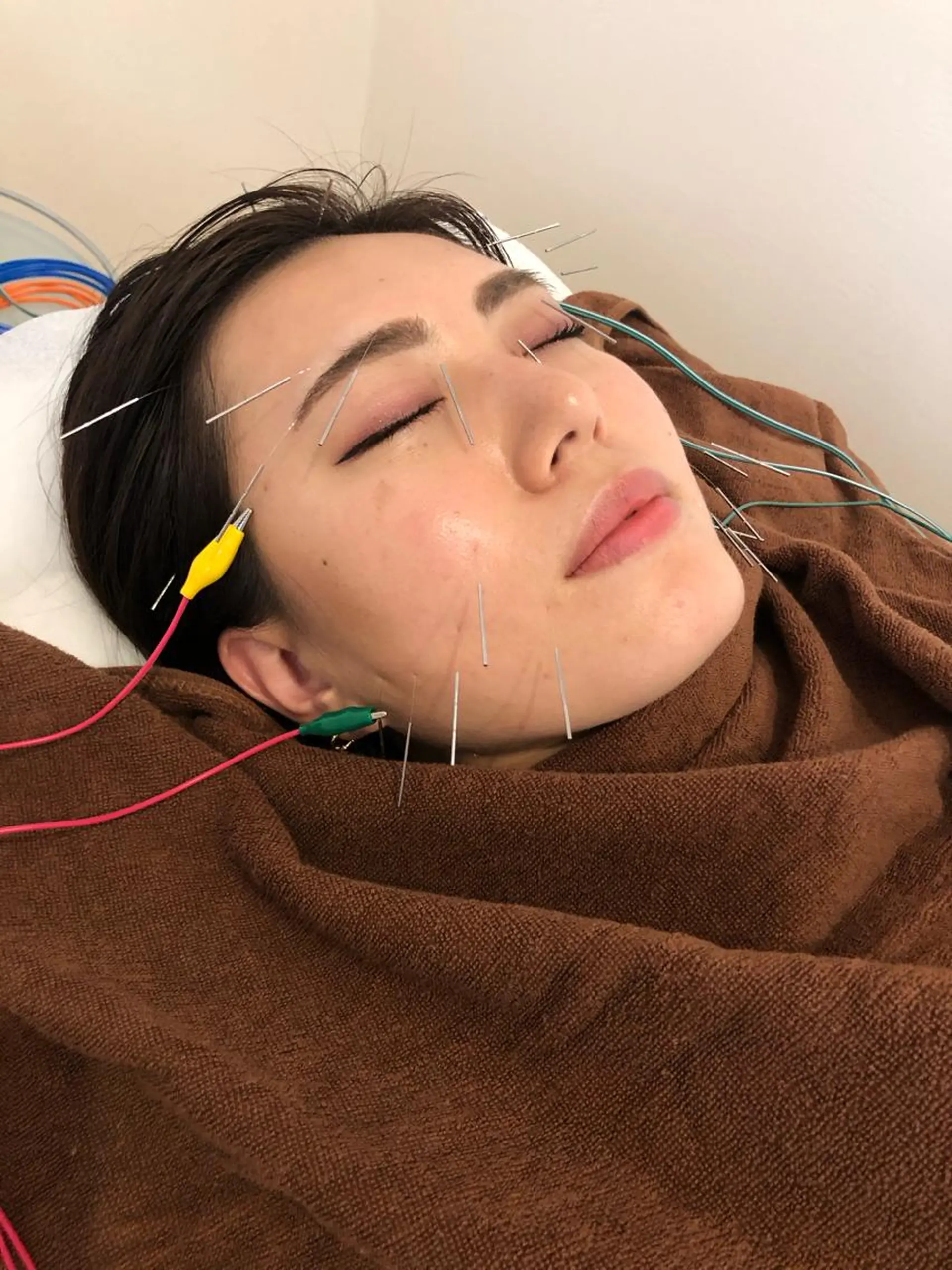 🐱美容鍼・整体 SBHメディカル👍のエステ・リラクイメージ