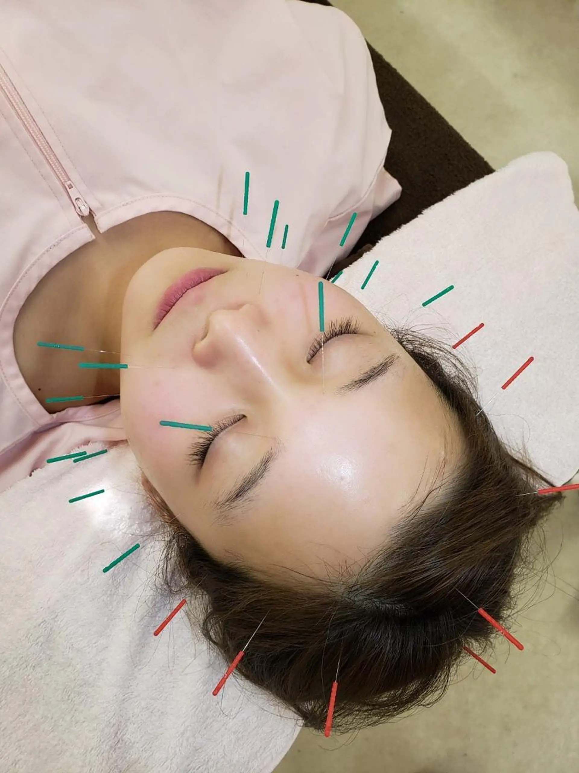 その他 やまだ鍼灸接骨院（やまだしんきゅうせっこついん）所属・山田 晃のエステ・リラクイメージ