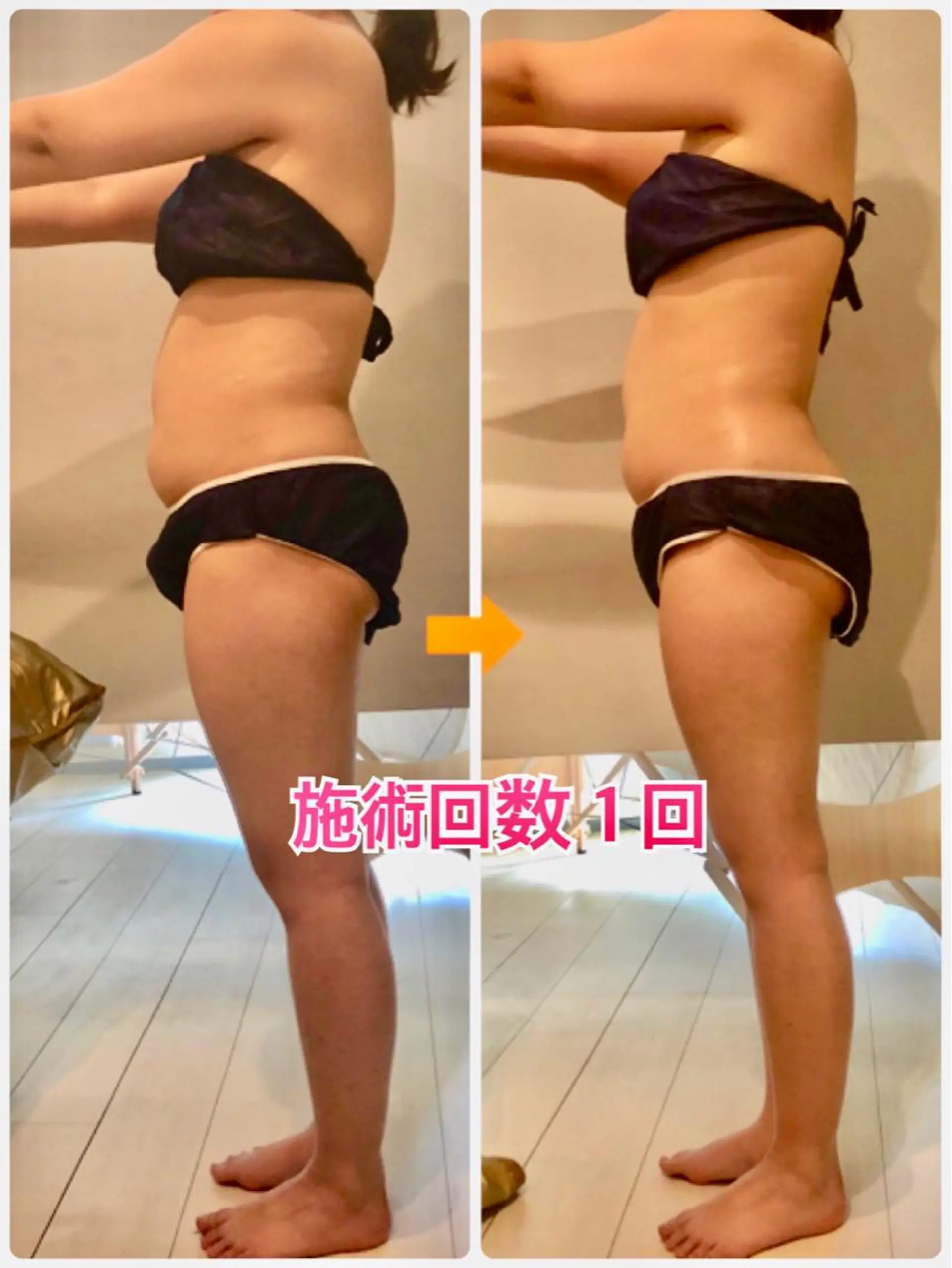 ショート カラー パーマ ヘアアレンジ メンズ キッズ ネイル マツエク・マツパ ‍痩身＆ボディ 結果出し🌟丹野のエステ・リラクイメージ