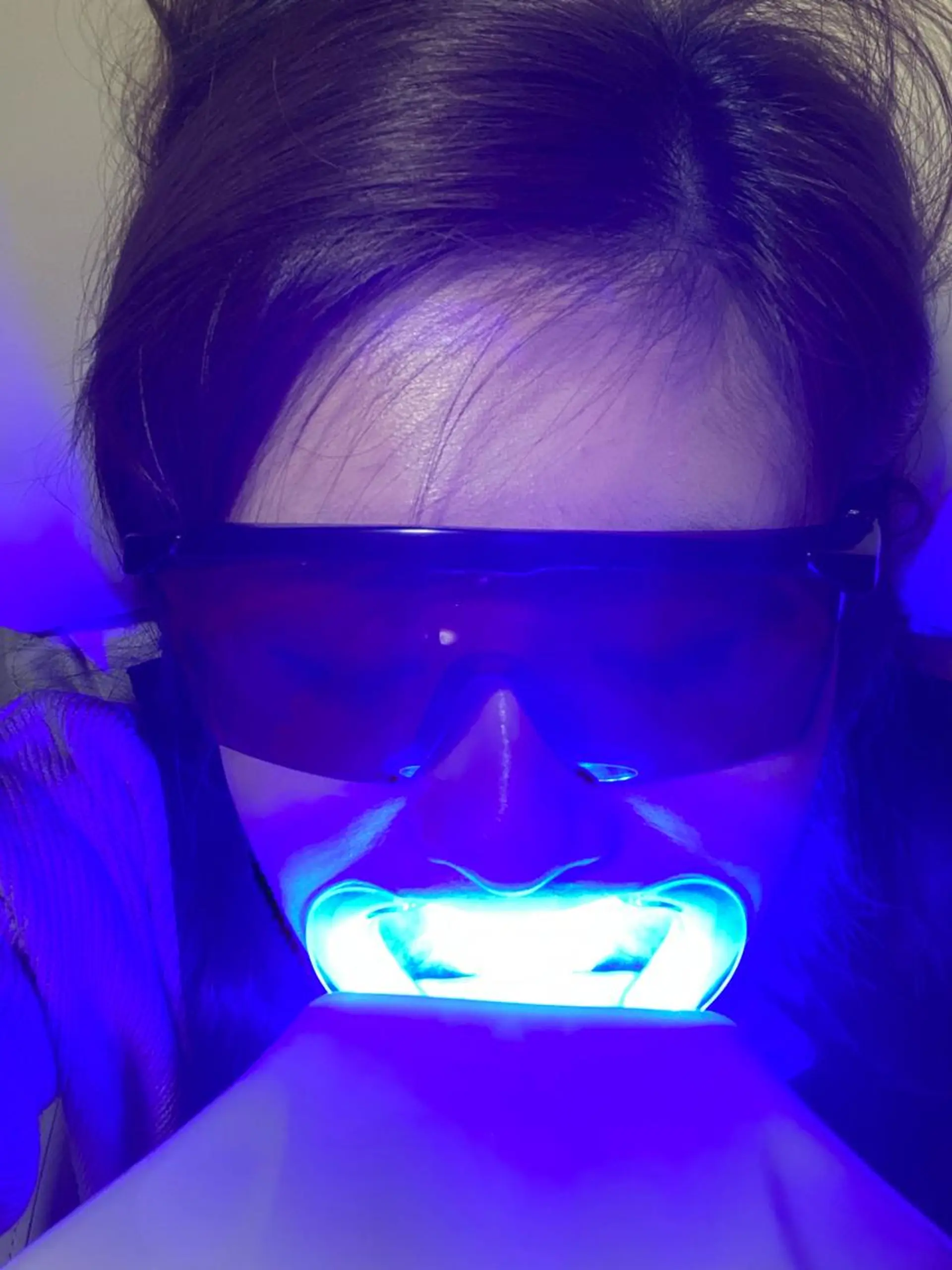 エステ リラク Twinkle White宇都宮店のその他イメージ