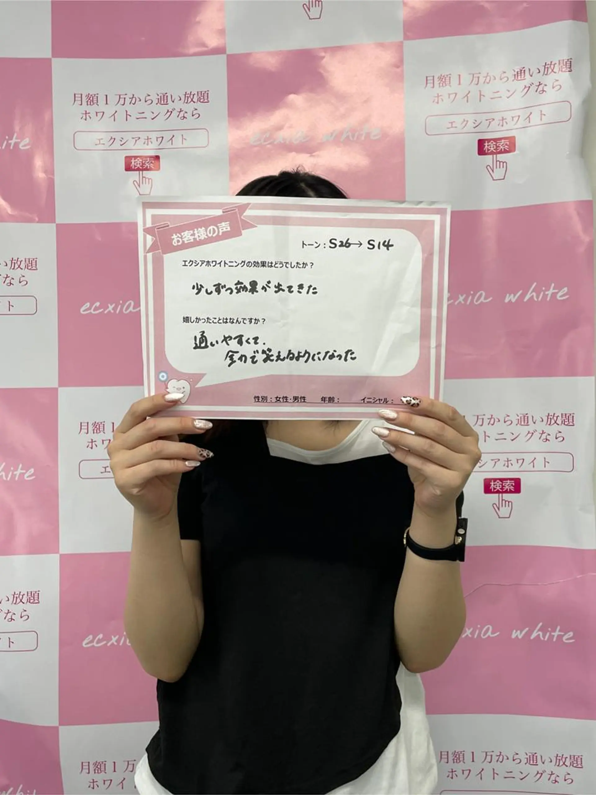 セルフホワイトニング エクシア金山のその他イメージ