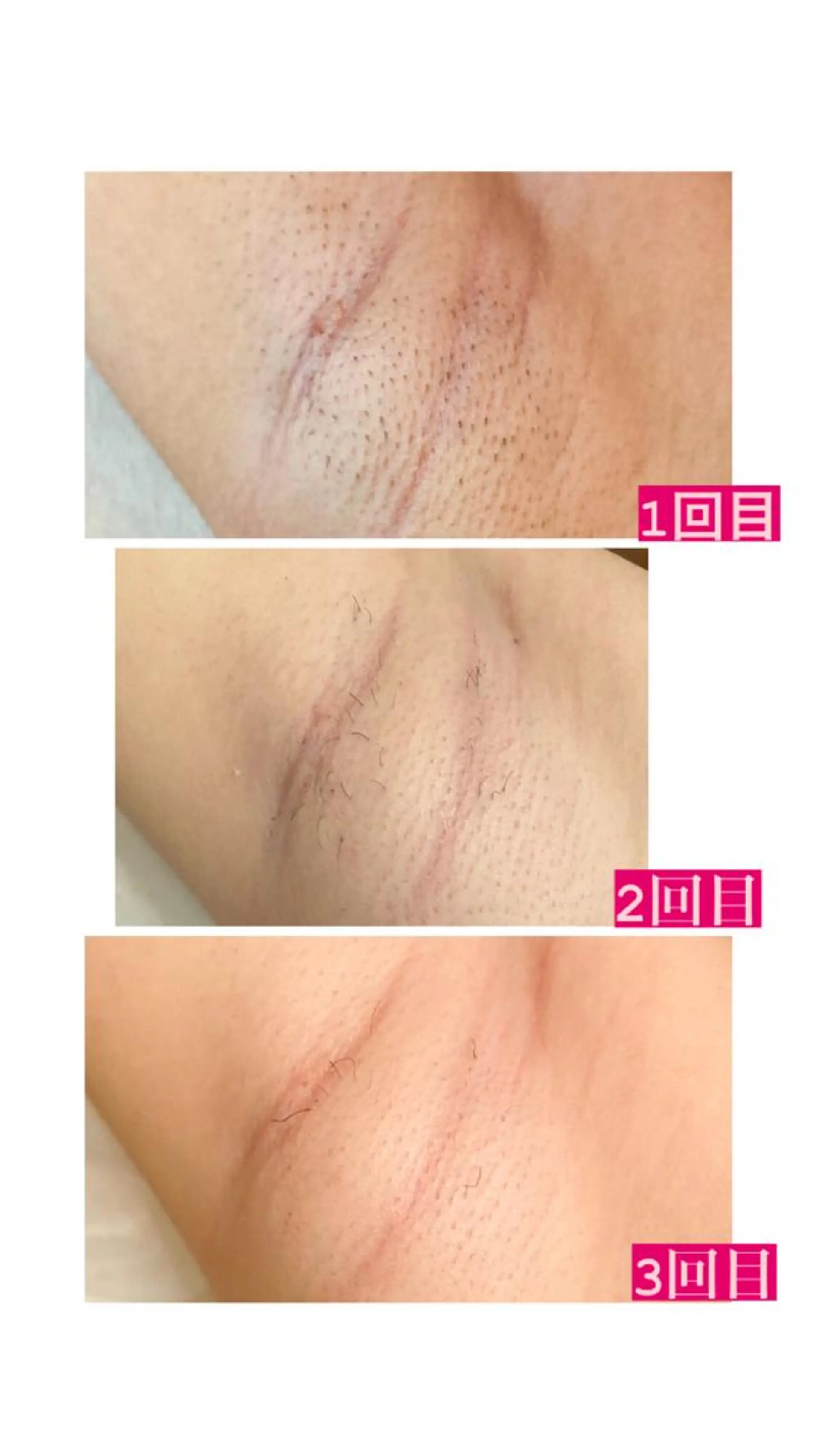 脱毛・エステサロン LuLuNのエステ・リラクイメージ