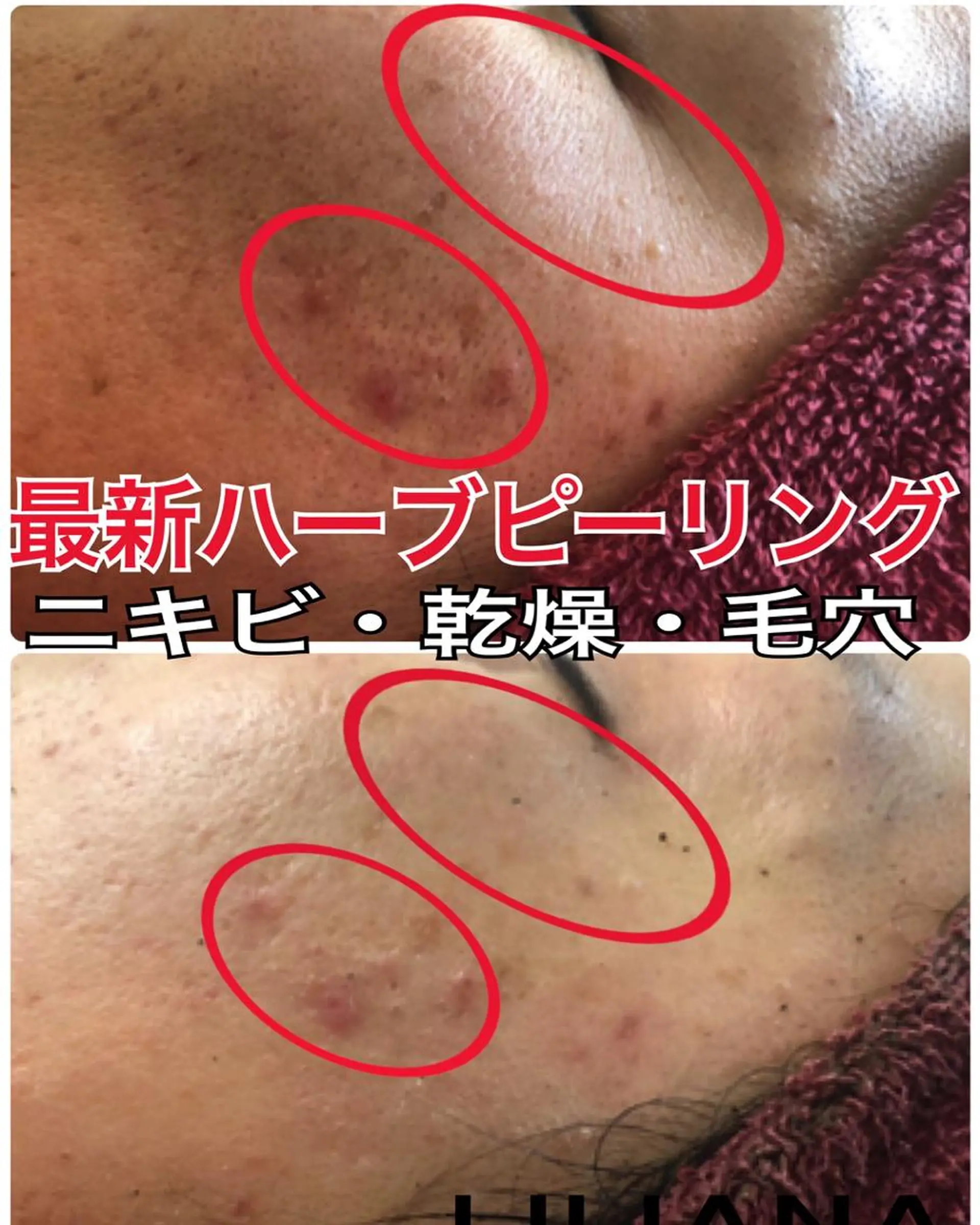 LILIANA所属・LILIANA ☆YURIのエステ・リラクイメージ