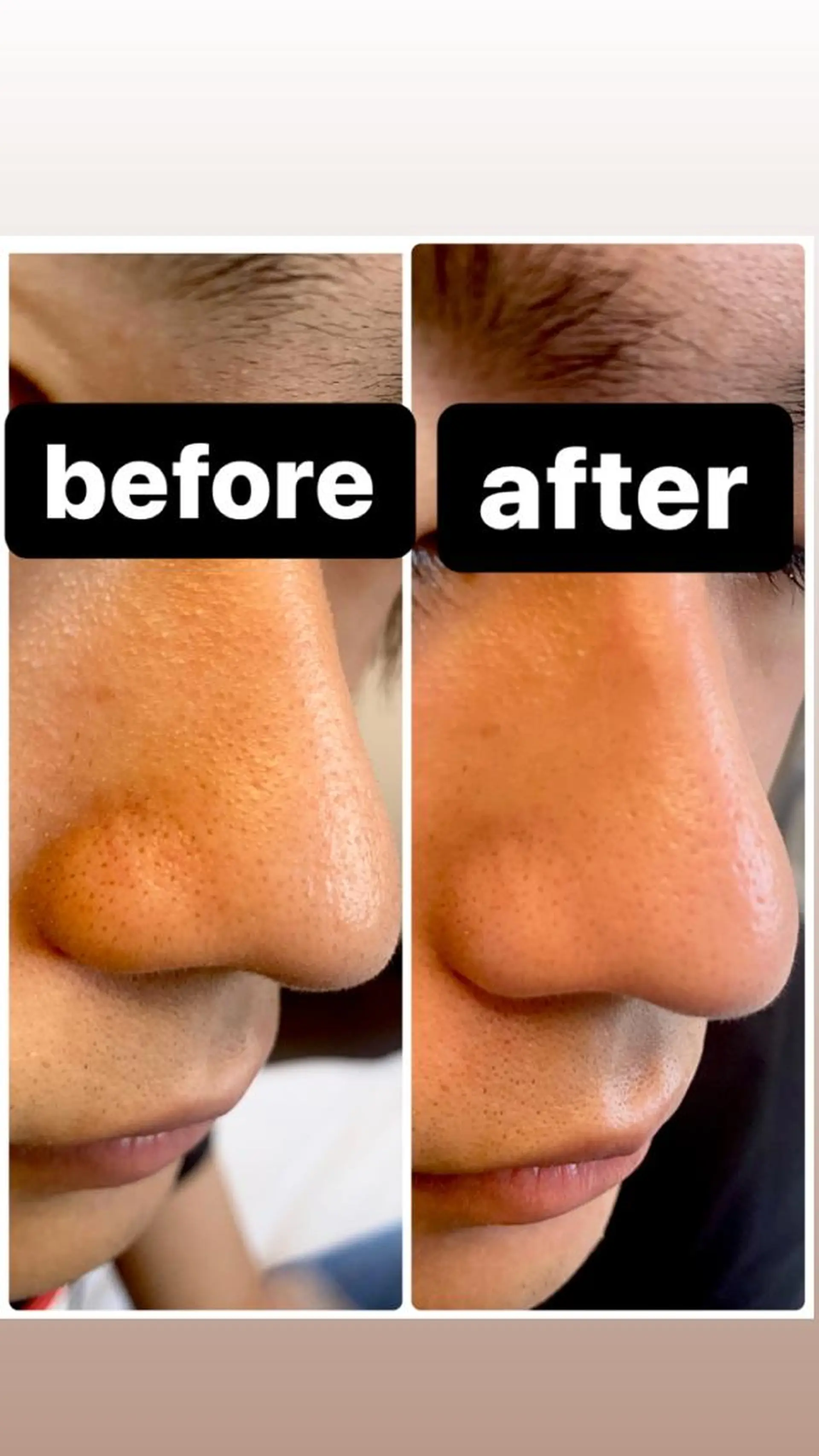 脱毛・エステサロン LuLuNのエステ・リラクイメージ