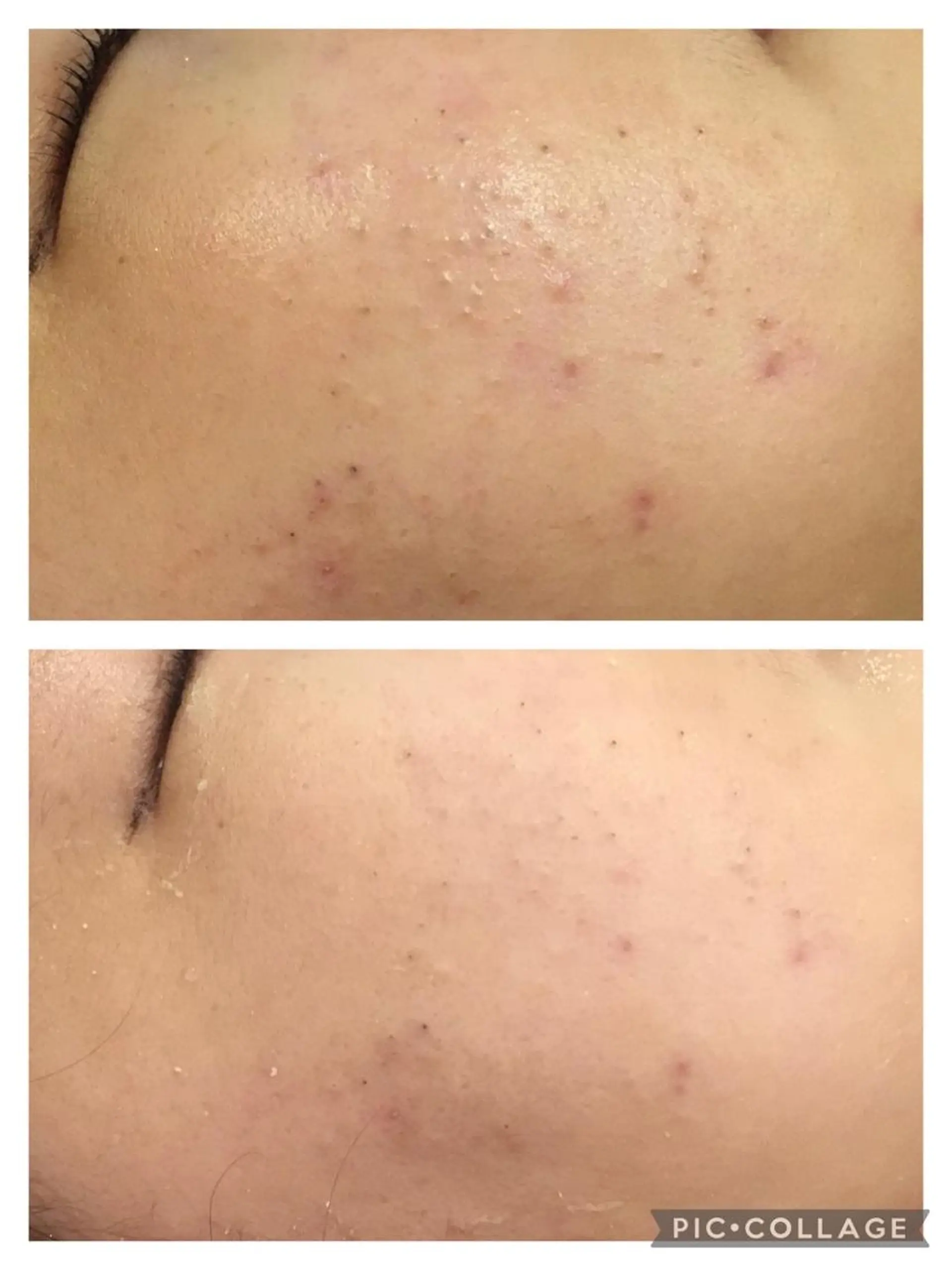 セミロング カラー パーマ ヘアアレンジ メンズ キッズ ネイル マツエク・マツパ アイブロウ 3か月で肌革命👼 ニキビ専門店💫のエステ・リラクイメージ