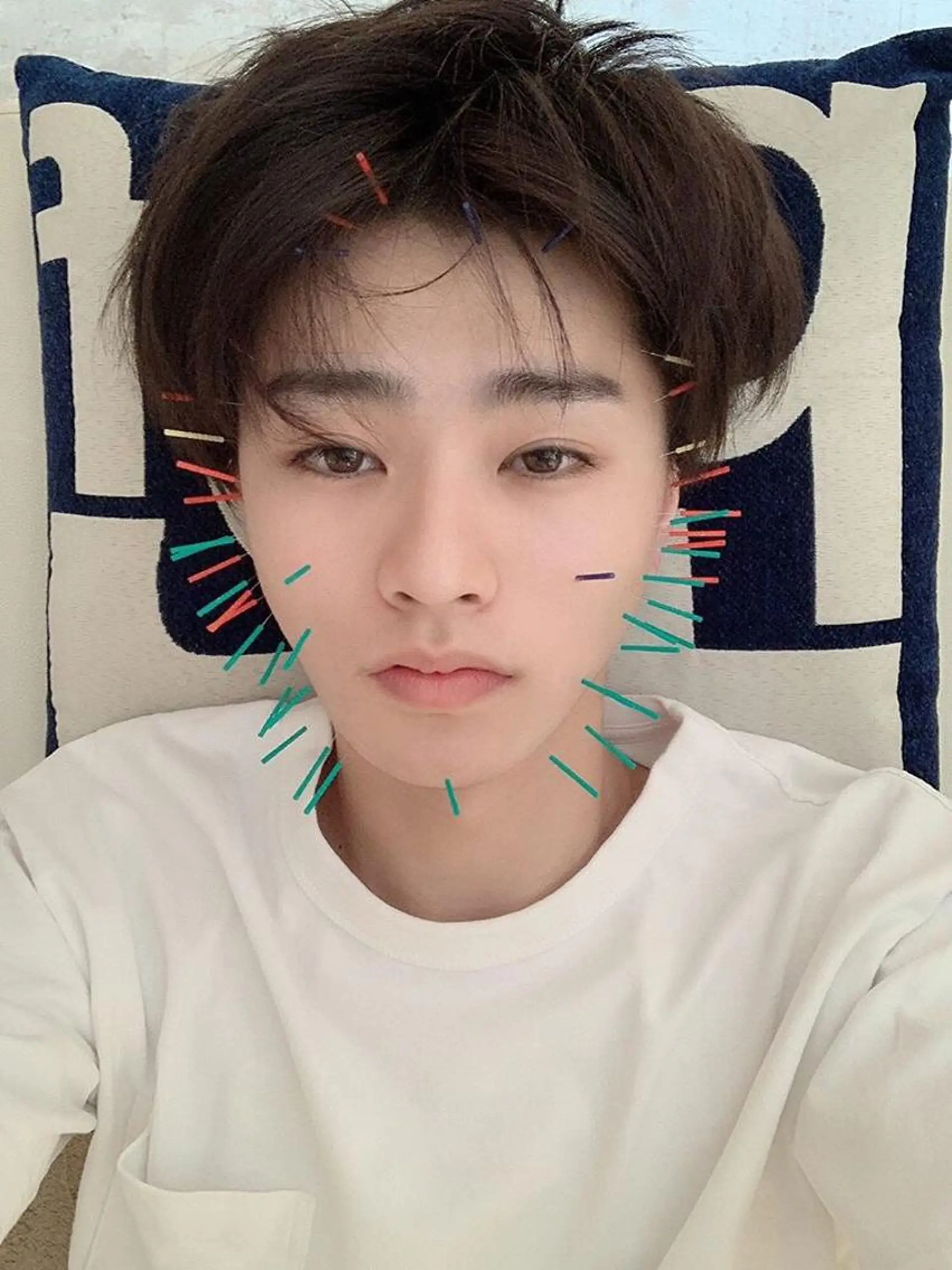 鍼灸 Refineのその他イメージ