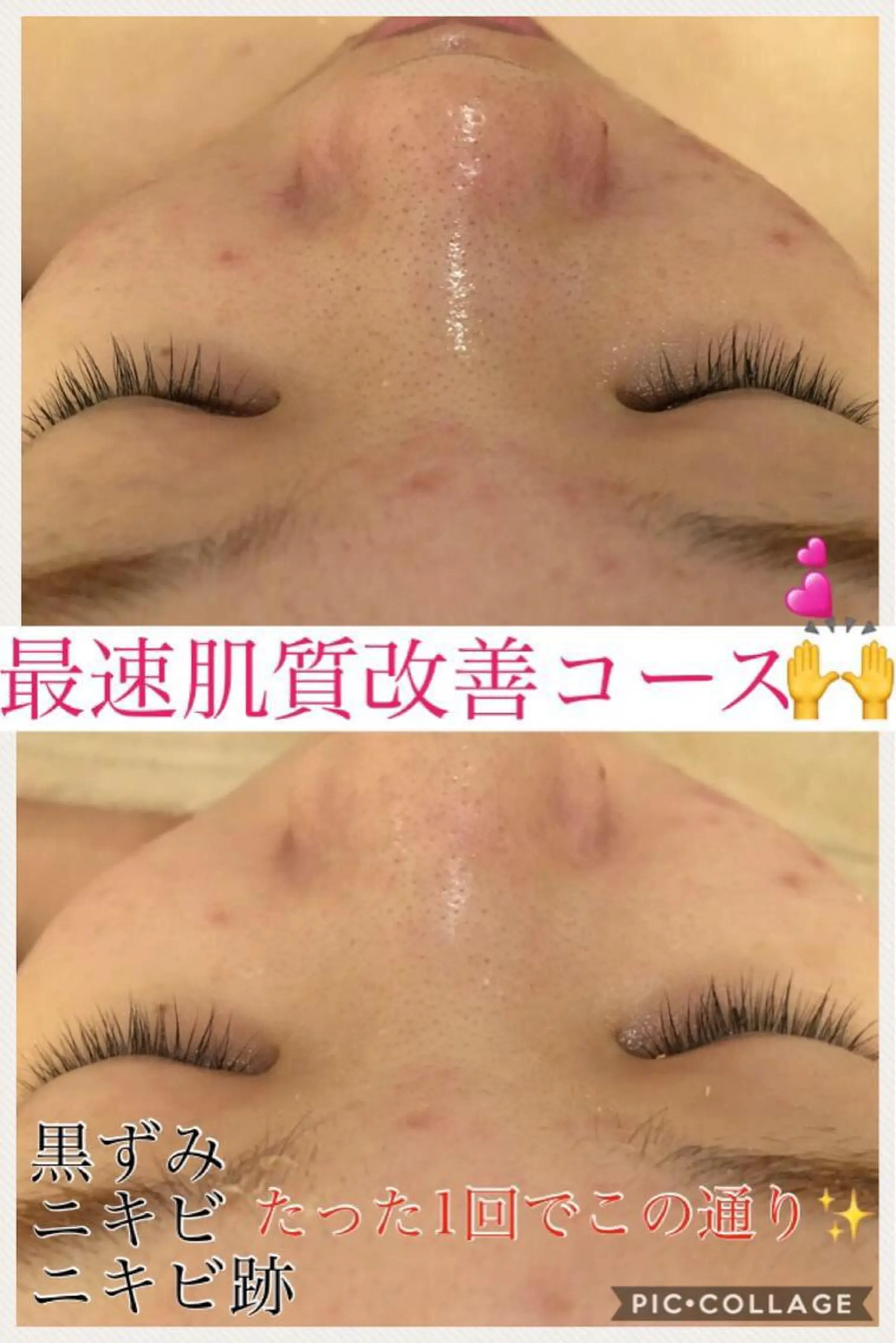 ショート カラー パーマ ヘアアレンジ メンズ キッズ ネイル マツエク・マツパ エステ リラク ニキビ・肌質改善専門 ♡人生が変わるサロンのエステ・リラクイメージ