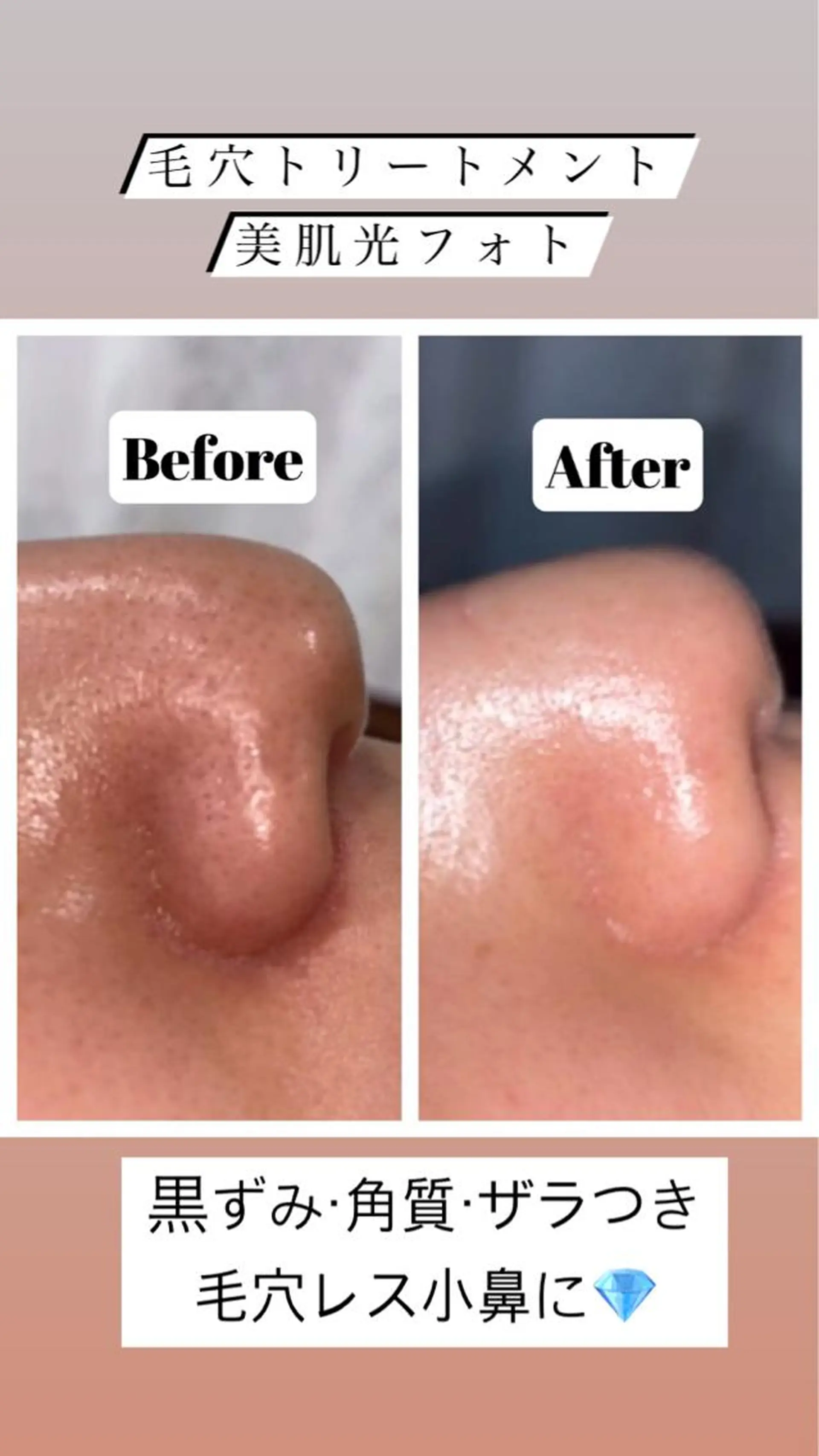 ミディアム カラー パーマ ヘアアレンジ メンズ キッズ ネイル マツエク・マツパ アイブロウ 学生（メンズ向け） 眉毛ワックス脱毛 学生 小顔カット トリートメント Chloe-クロエ- 脱毛/フェイシャルのエステ・リラクイメージ