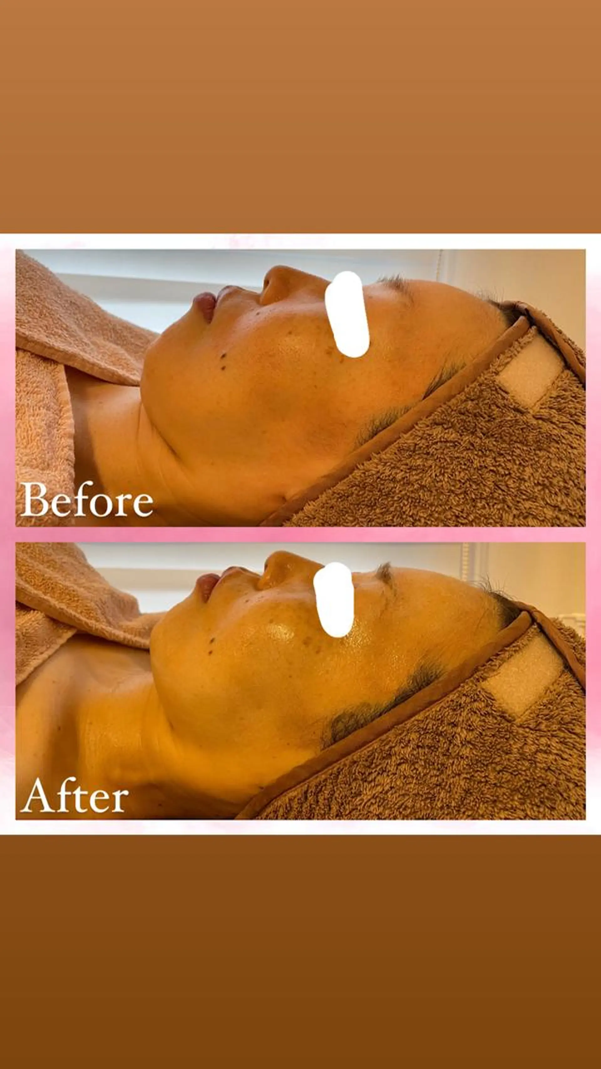 エステ 山﨑 藍のエステ・リラクイメージ