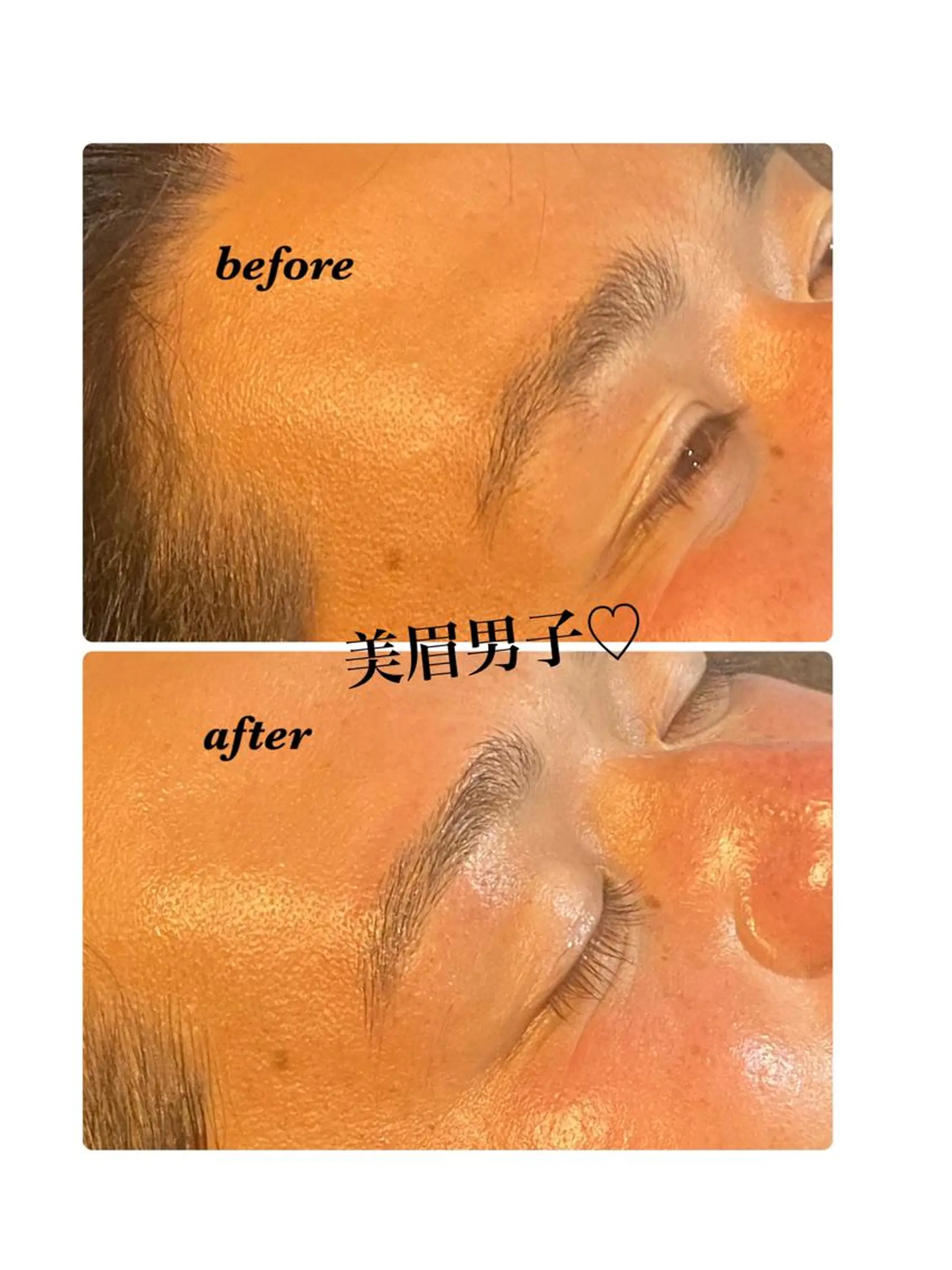 アイブロウ ハーブピーリング/韓国肌管理/フェイシャル/毛穴洗浄/眉毛/顔脱毛【糸脱毛専門】rev所属・ハーブピーリング専門 毛穴洗浄❤️眉waxのエステ・リラクイメージ