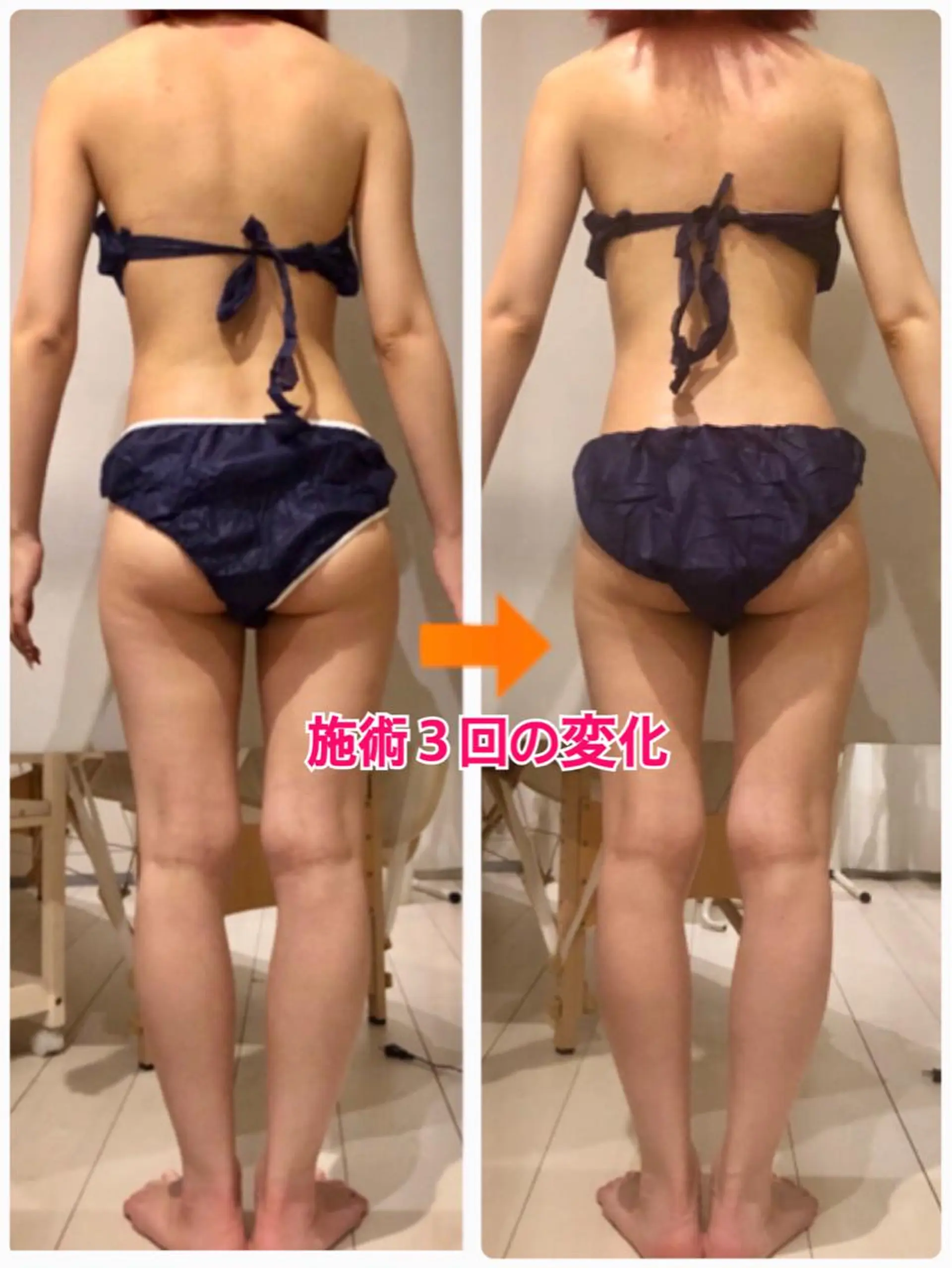 ロング カラー パーマ ヘアアレンジ メンズ キッズ ネイル マツエク・マツパ ‍痩身＆ボディ 結果出し🌟丹野のエステ・リラクイメージ