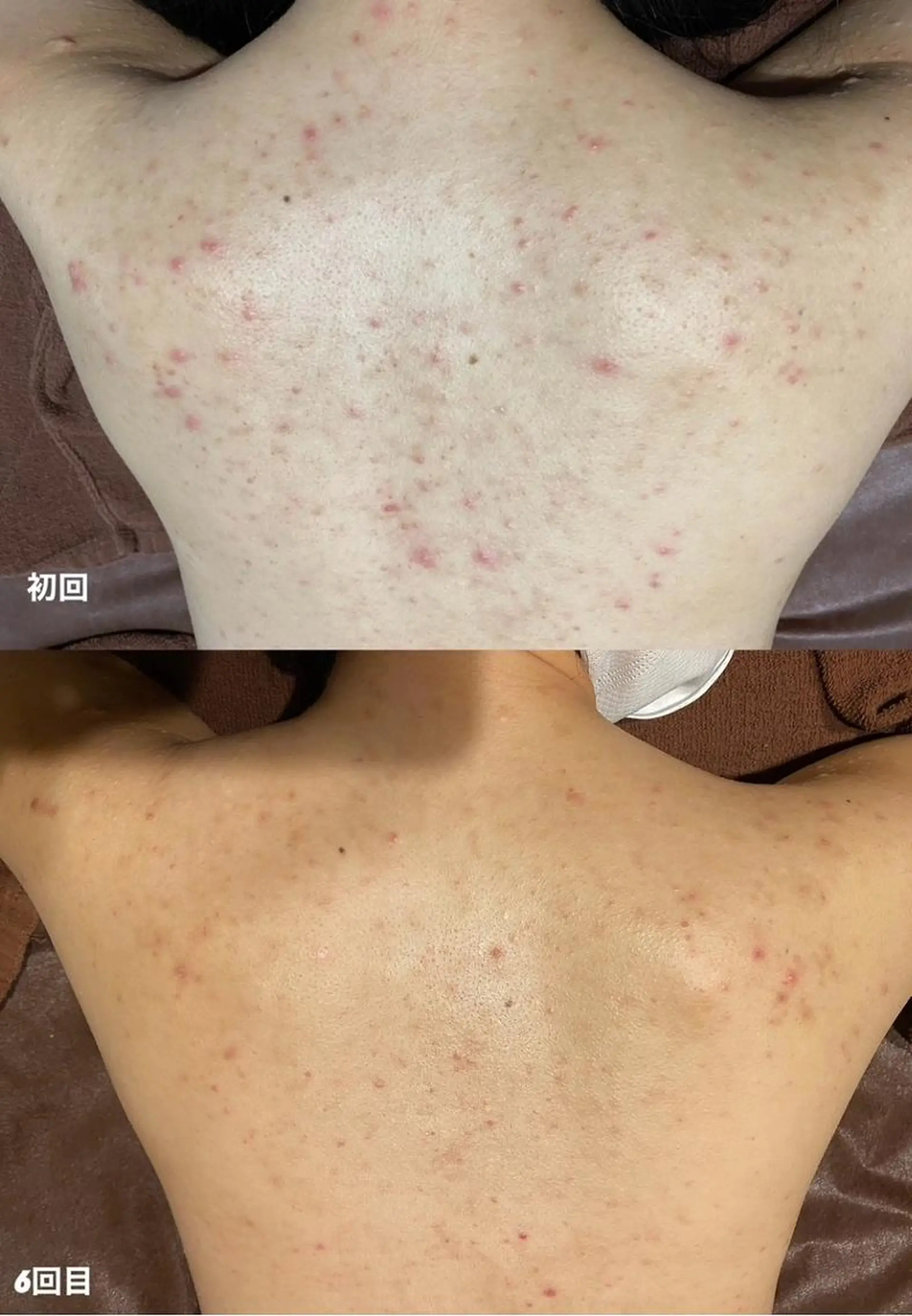 Fleur フルールのエステ・リラクイメージ