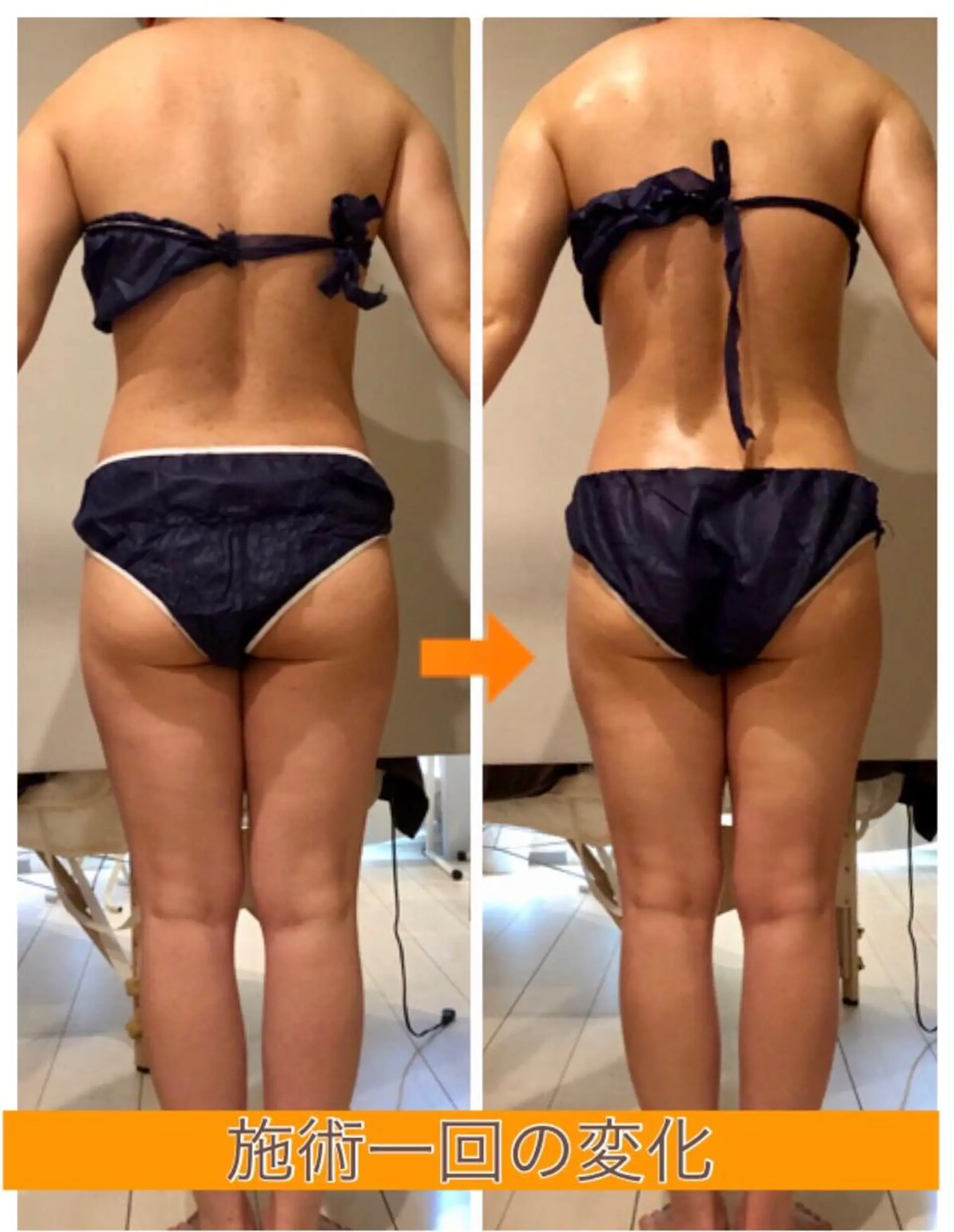 ロング カラー パーマ ヘアアレンジ メンズ キッズ ネイル マツエク・マツパ ‍痩身＆ボディ 結果出し🌟丹野のエステ・リラクイメージ