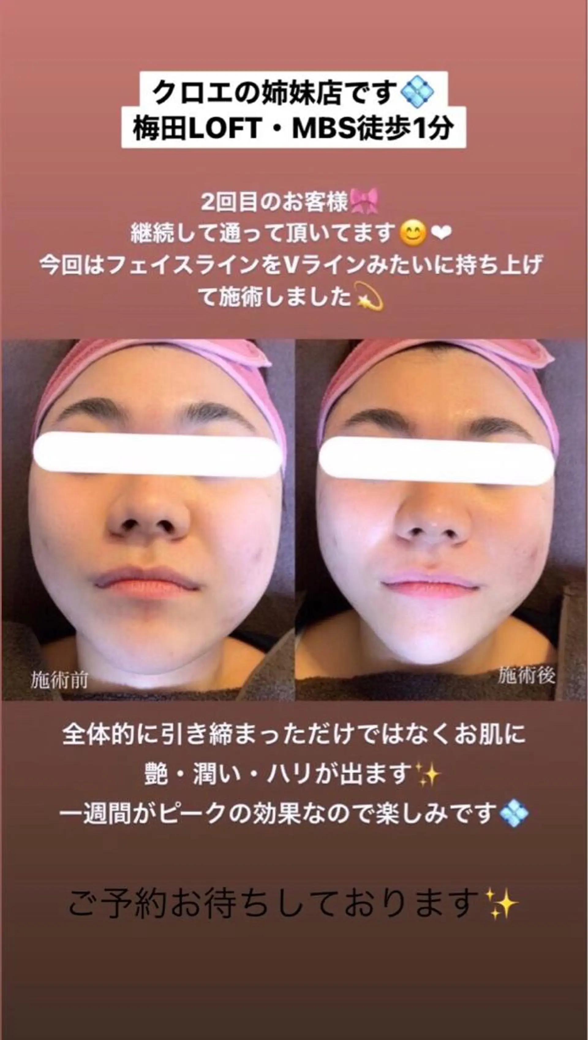 セミロング カラー パーマ ヘアアレンジ メンズ キッズ ネイル マツエク・マツパ Chloe-クロエ- 脱毛/フェイシャルのエステ・リラクイメージ