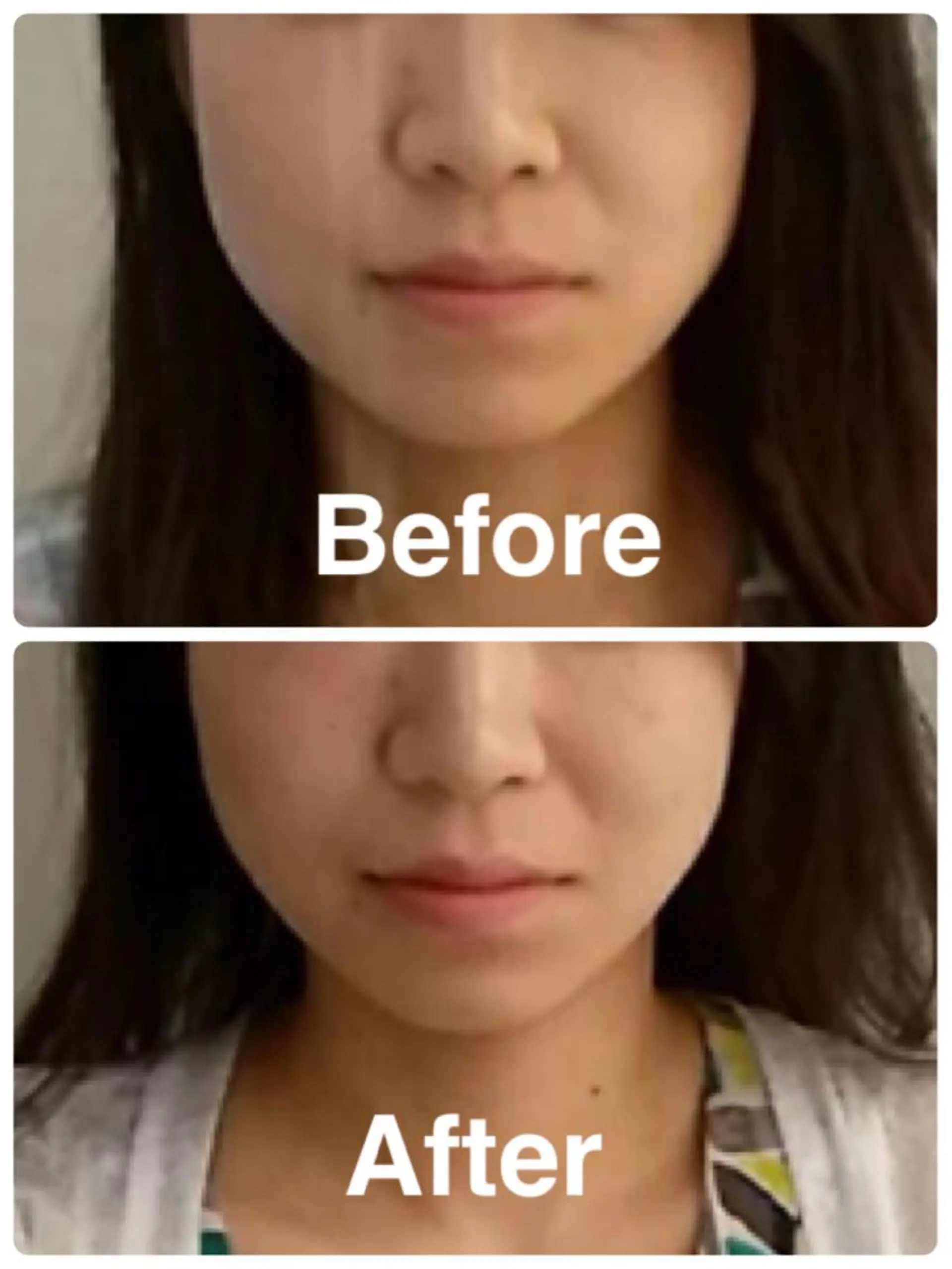 鍼灸 Refineのその他イメージ