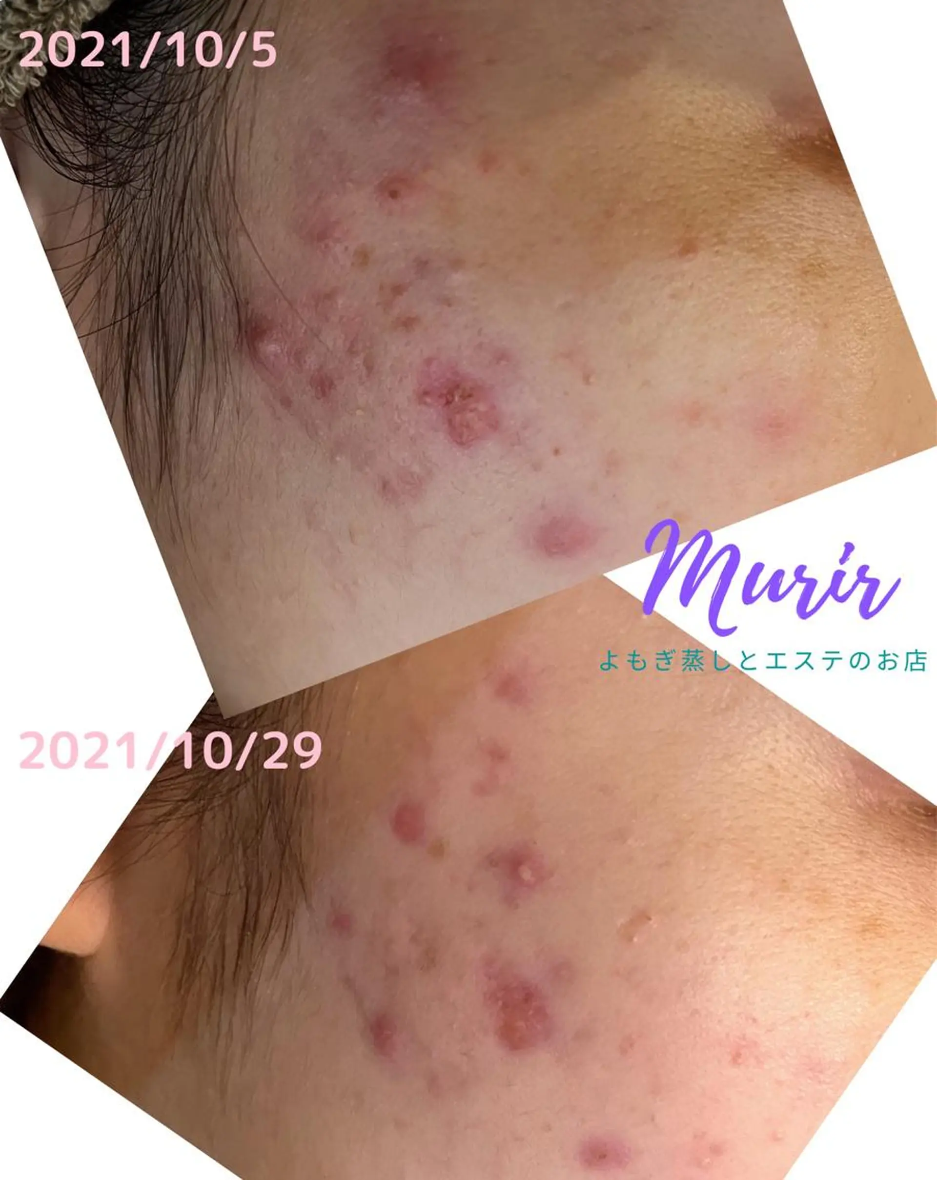 肌質体質改善サロン ミュリール 橋本店のエステ・リラクイメージ