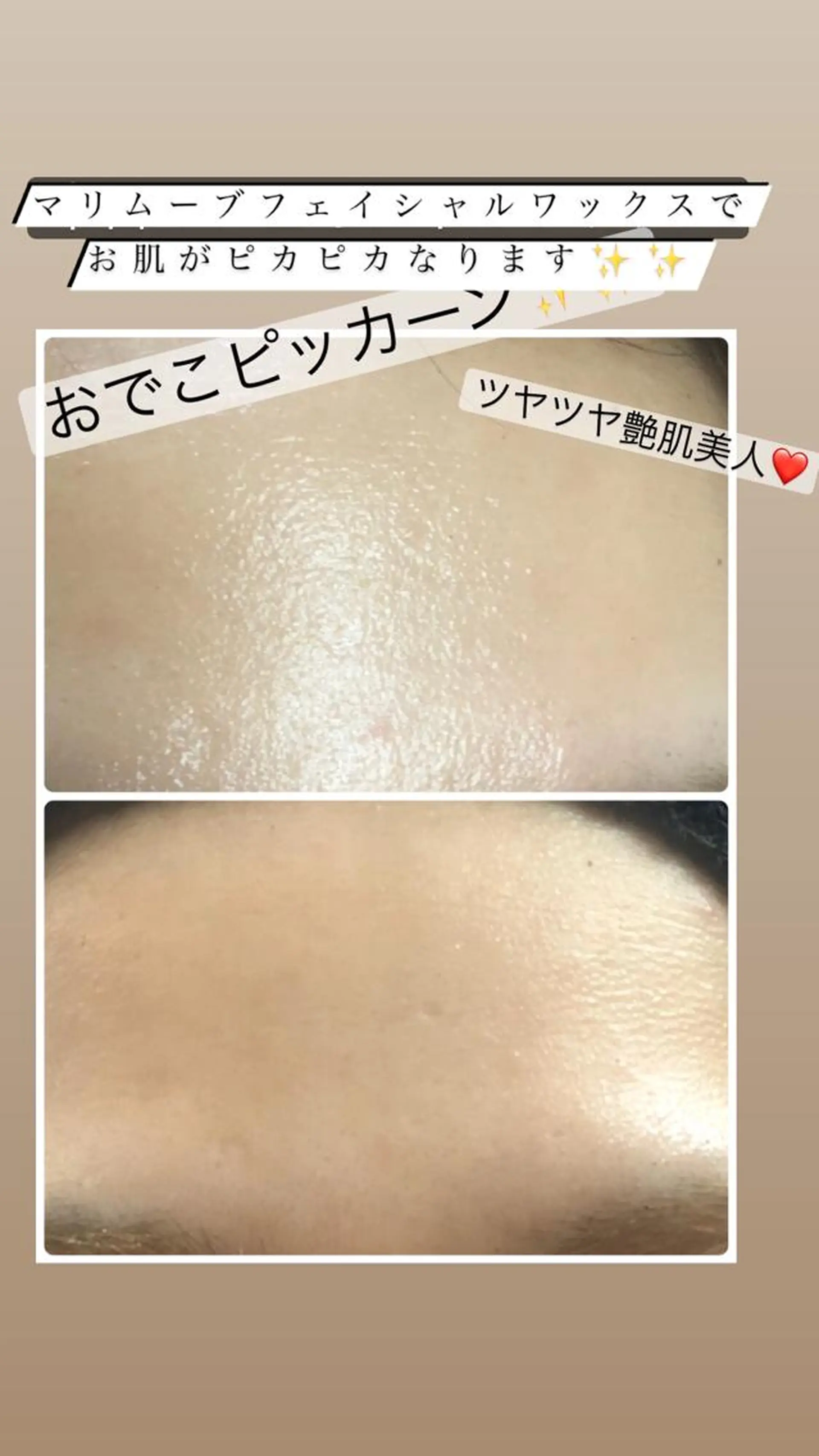 宜野湾美肌脱毛fuu okinawaタイラのエステ・リラクイメージ