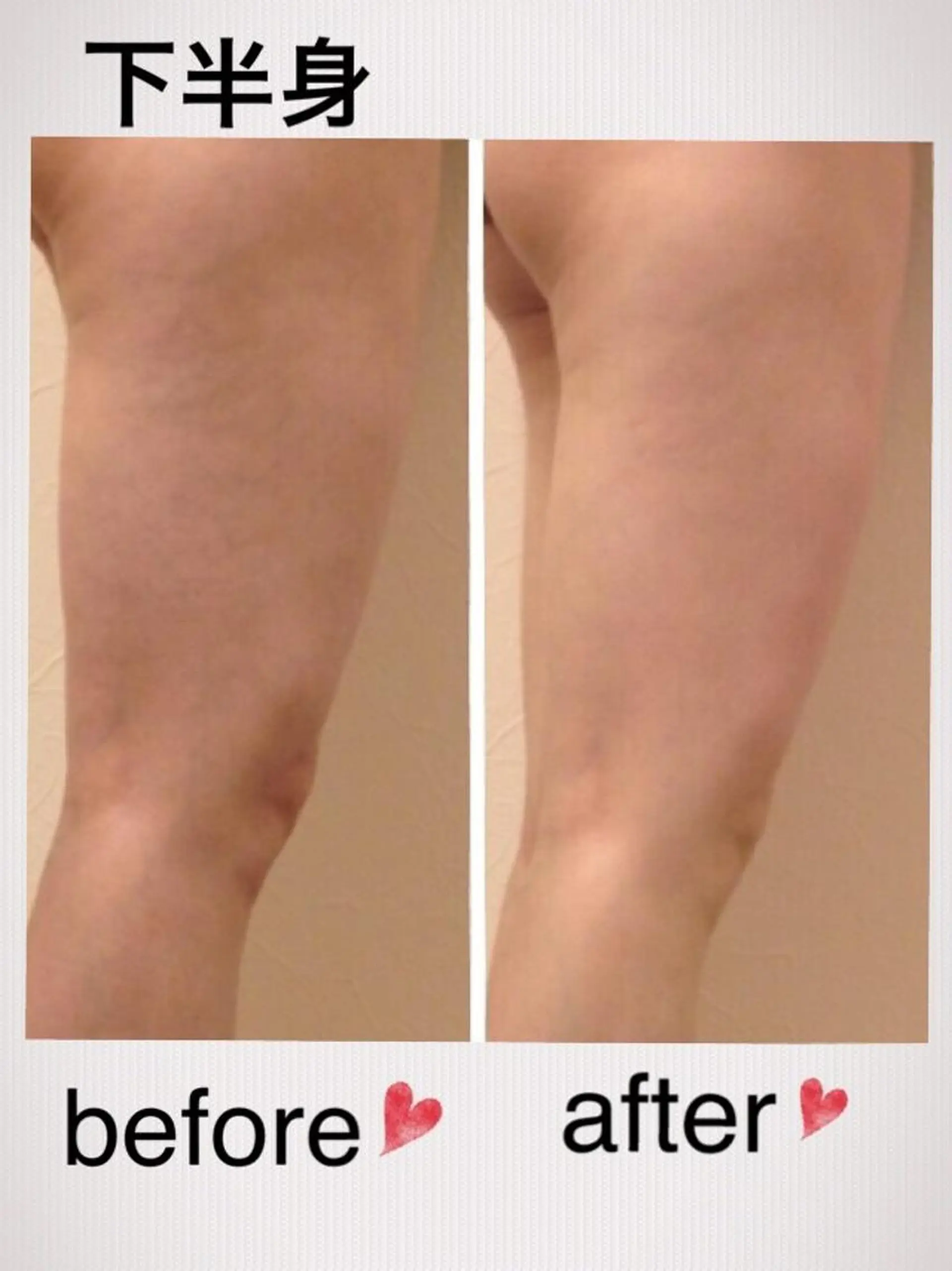 エステ リラク 肌管理専門 BACI夙川サロンのエステ・リラクイメージ