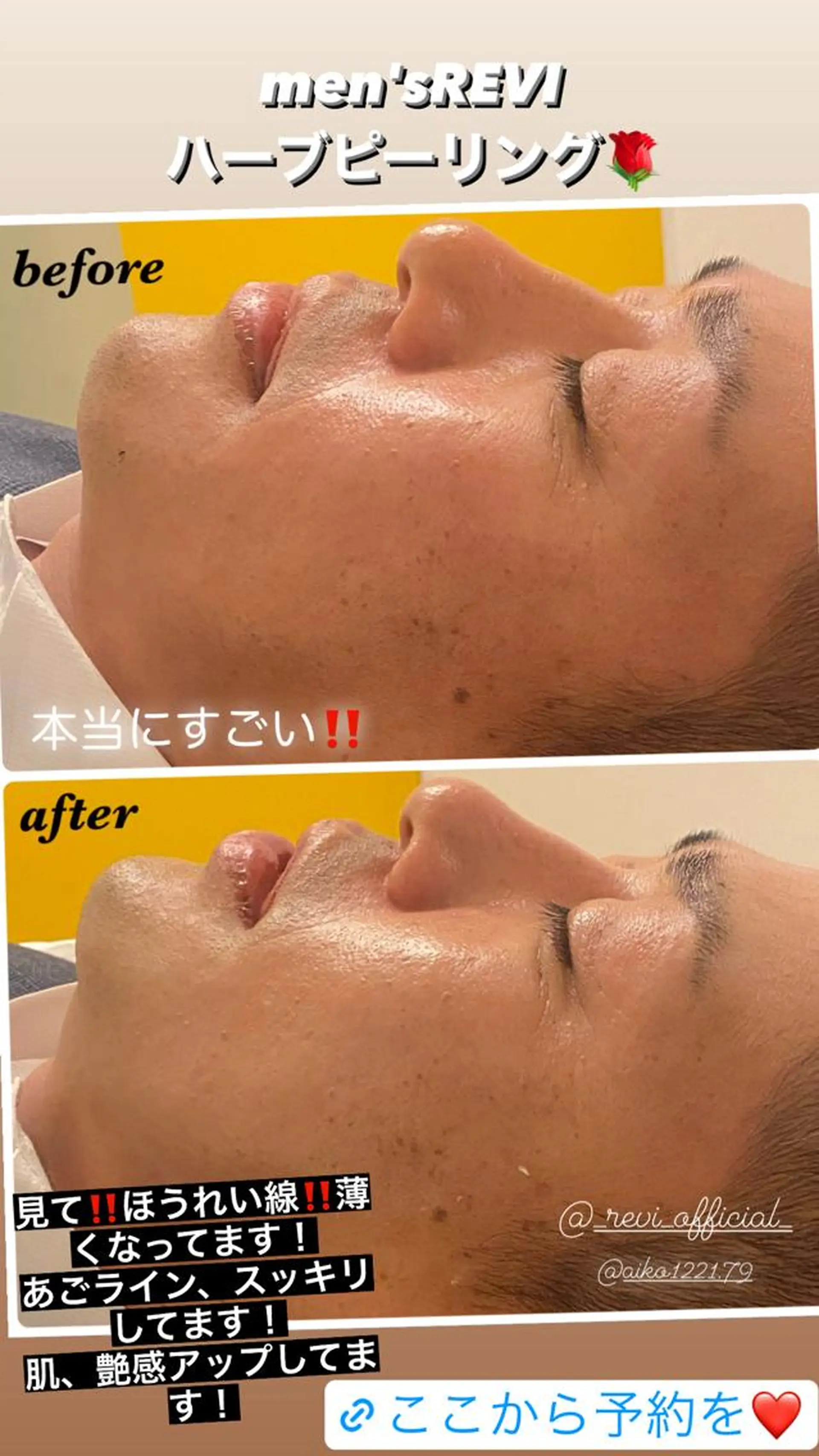 ハーブピーリング専門 毛穴洗浄❤️眉waxのエステ・リラクイメージ