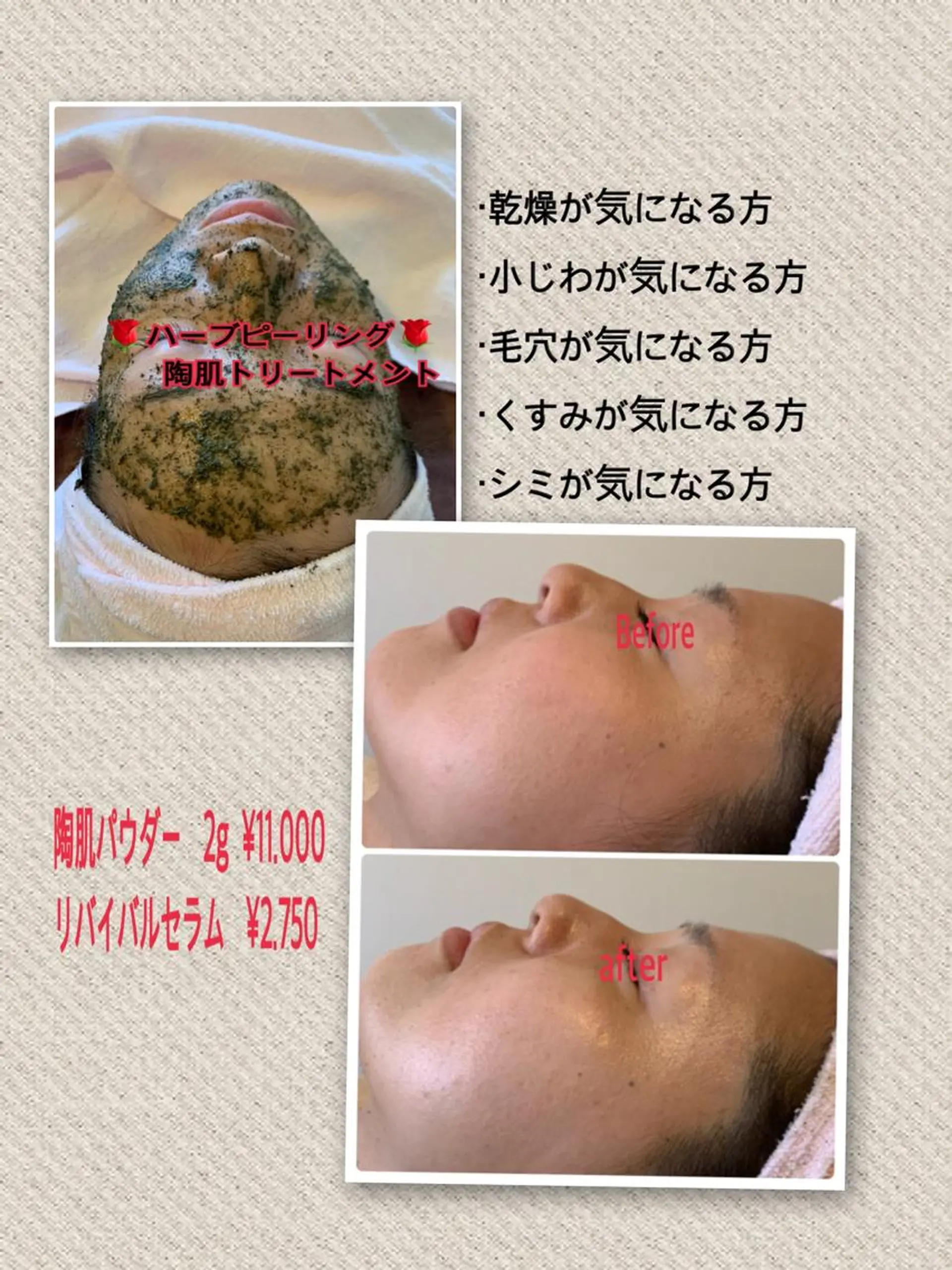 espoir エスポワールのエステ・リラクイメージ