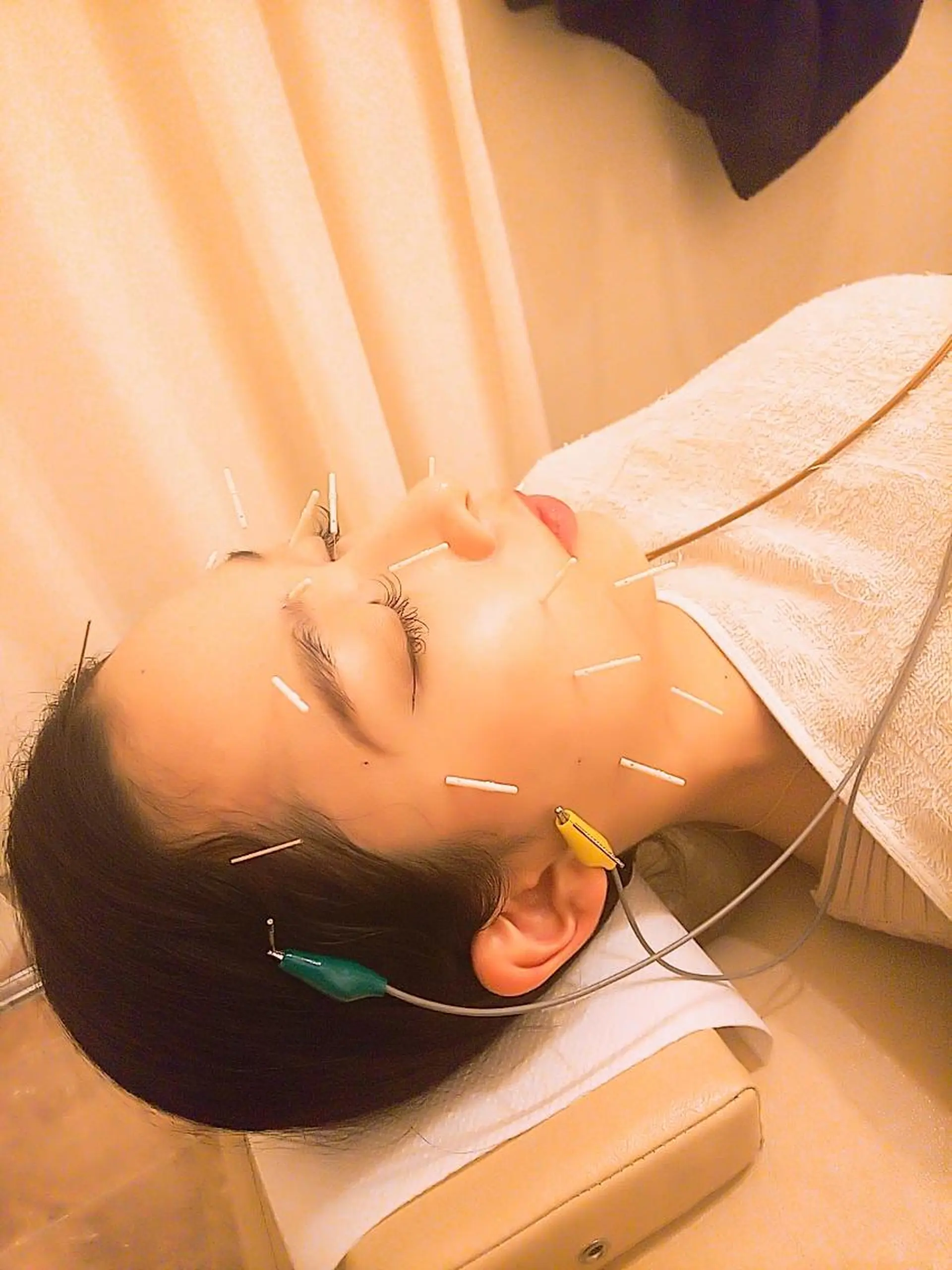 むくみたるみ専門☆ 美容鍼・小顔矯正のエステ・リラクイメージ