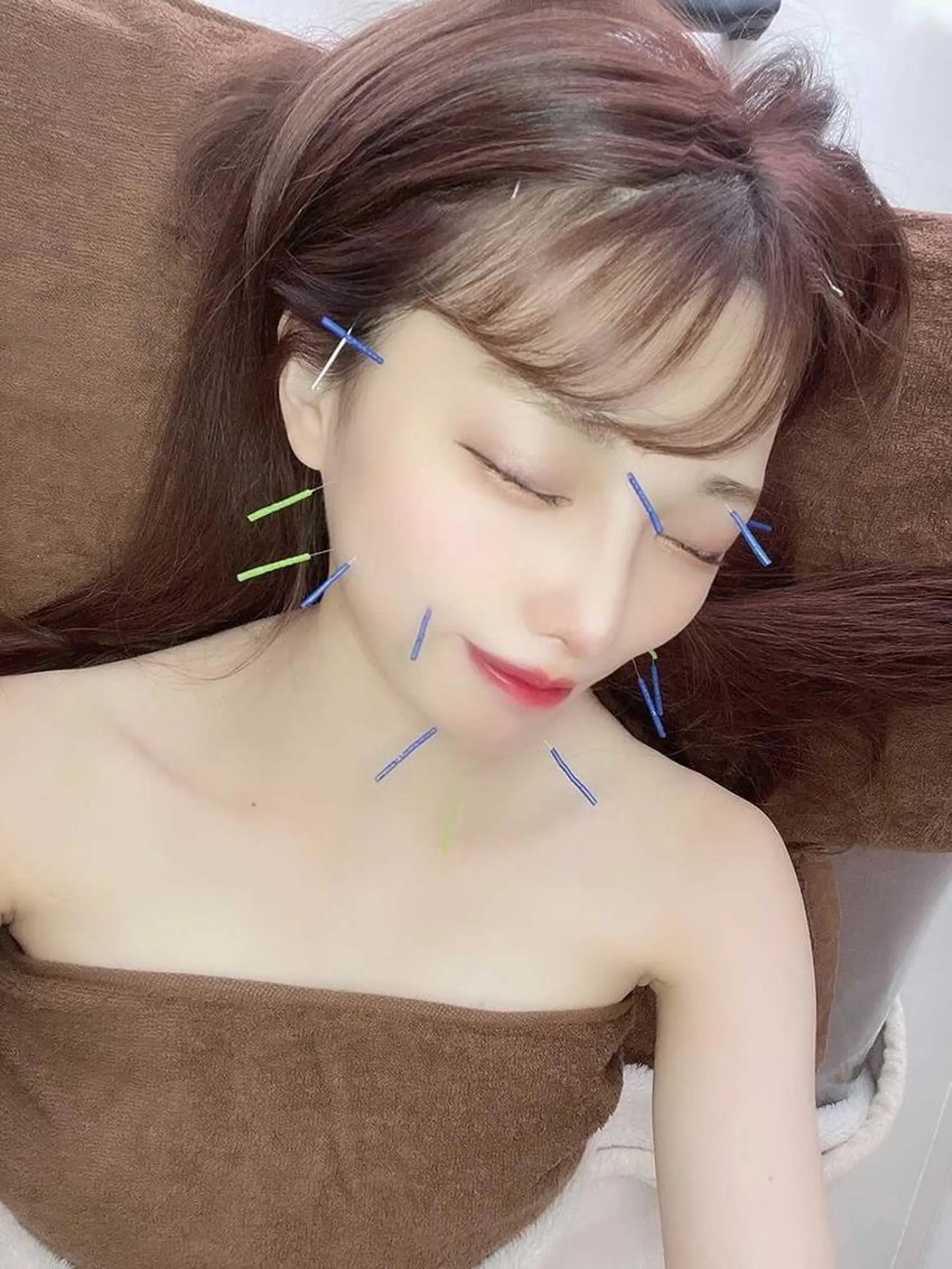 心斎橋痩身ダイエット 韓国.美容鍼.小顔のエステ・リラクイメージ