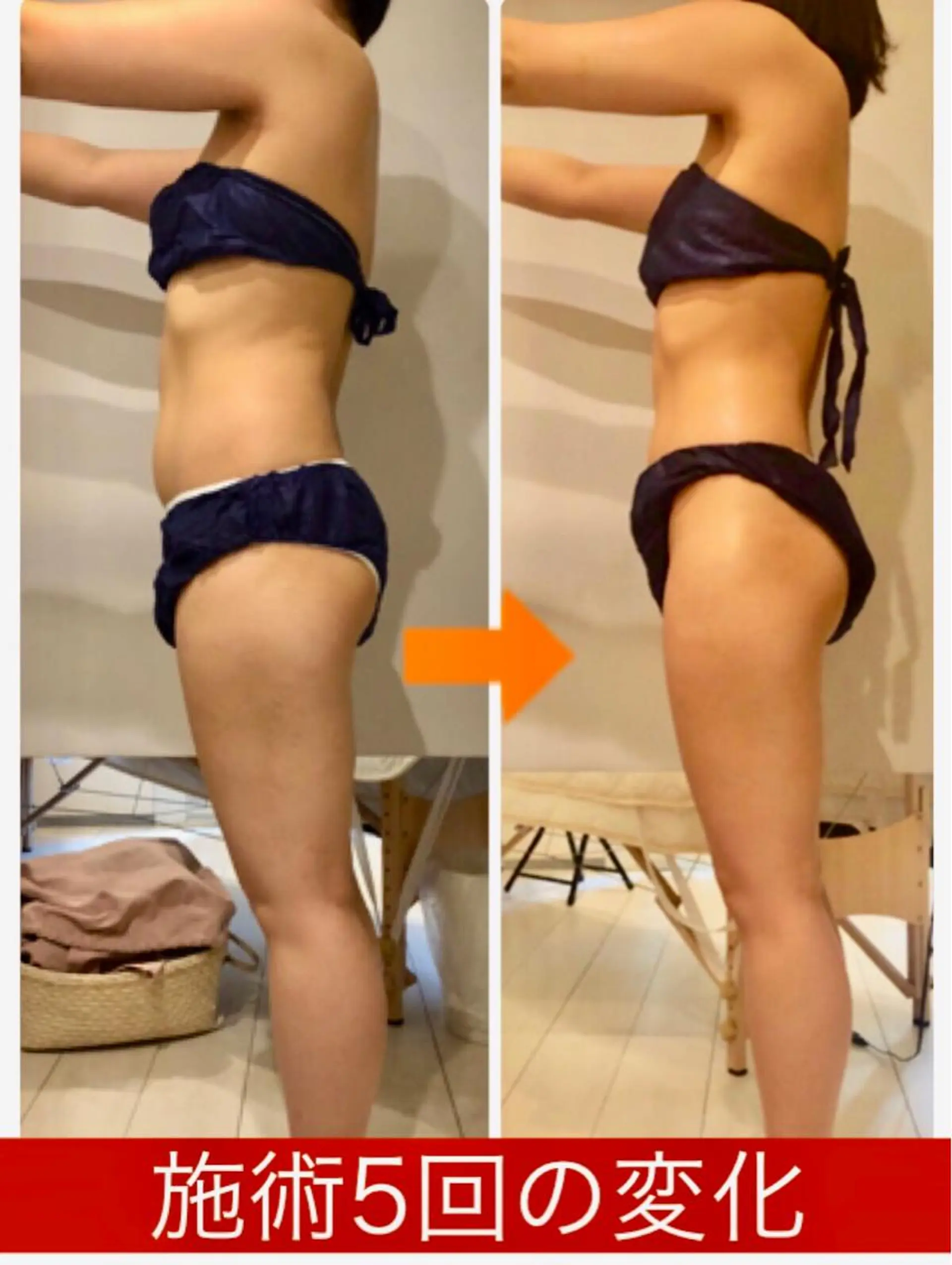 ショート カラー パーマ ヘアアレンジ メンズ キッズ ネイル マツエク・マツパ くびれヘア マットネイル 赤色 ‍痩身＆ボディ 結果出し🌟丹野のエステ・リラクイメージ