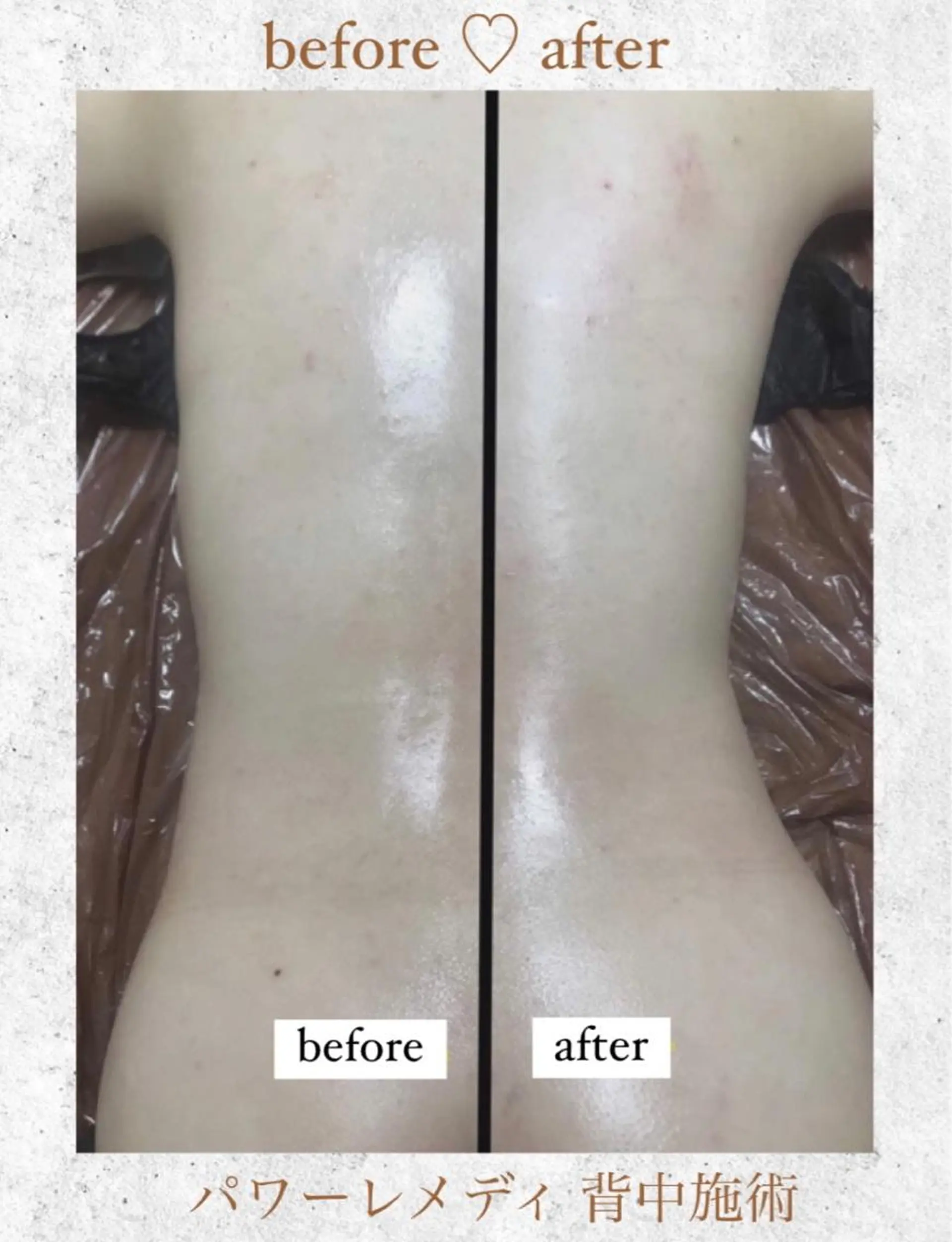 《本気痩せ×疲労改善 》  BILOOPのエステ・リラクイメージ