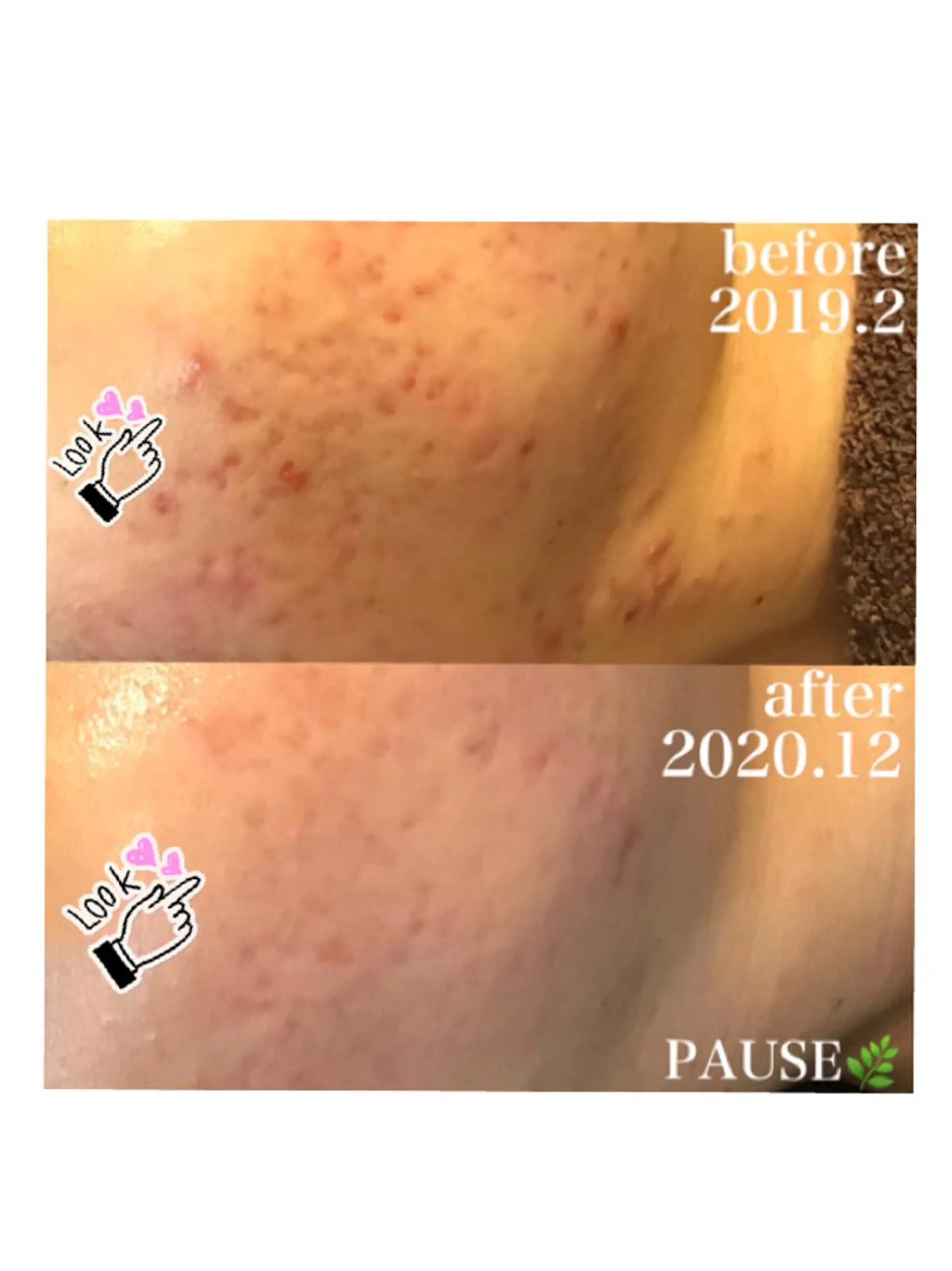 エステ 浜野 恵美のエステ・リラクイメージ