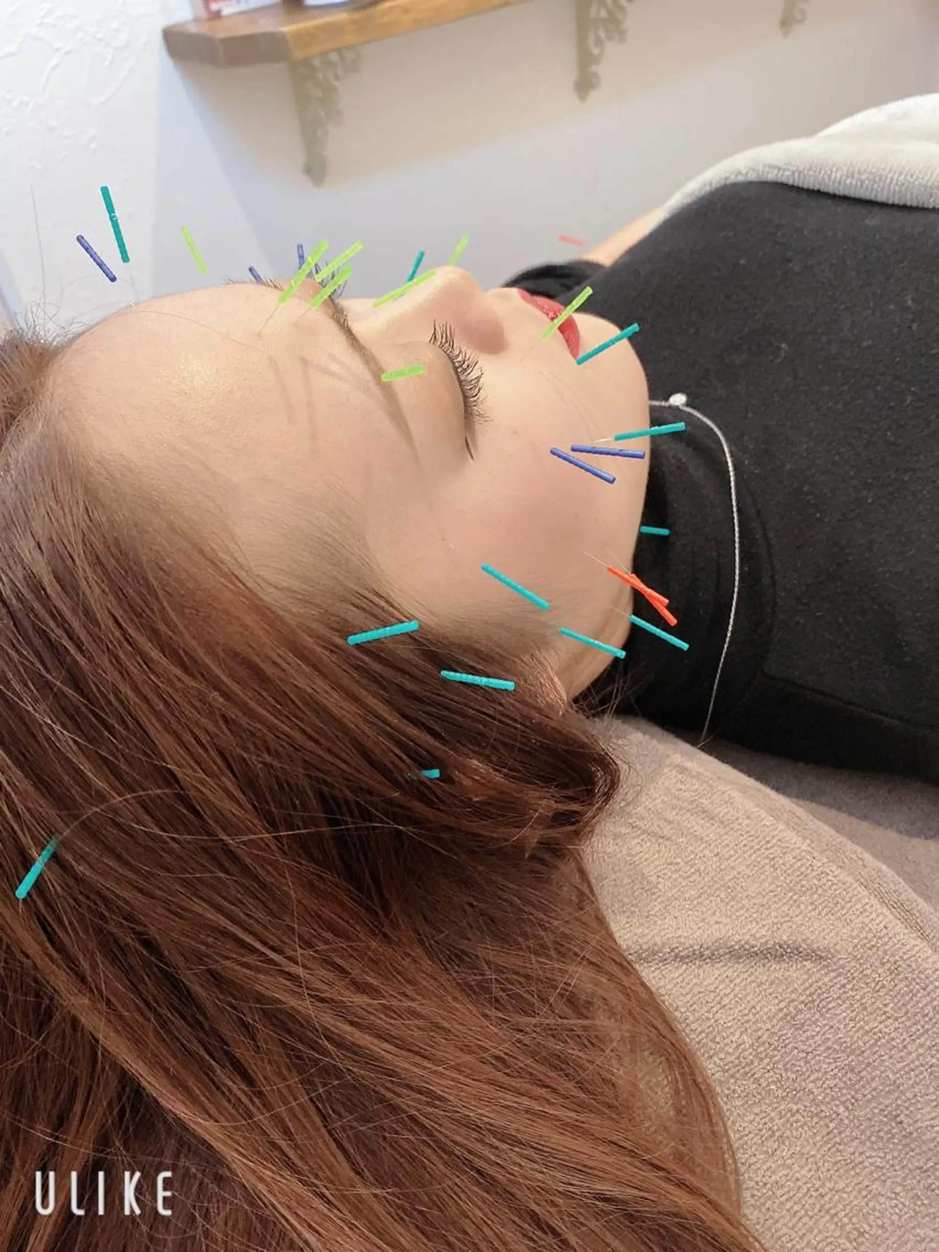 美容鍼灸サロン yin yangのその他イメージ