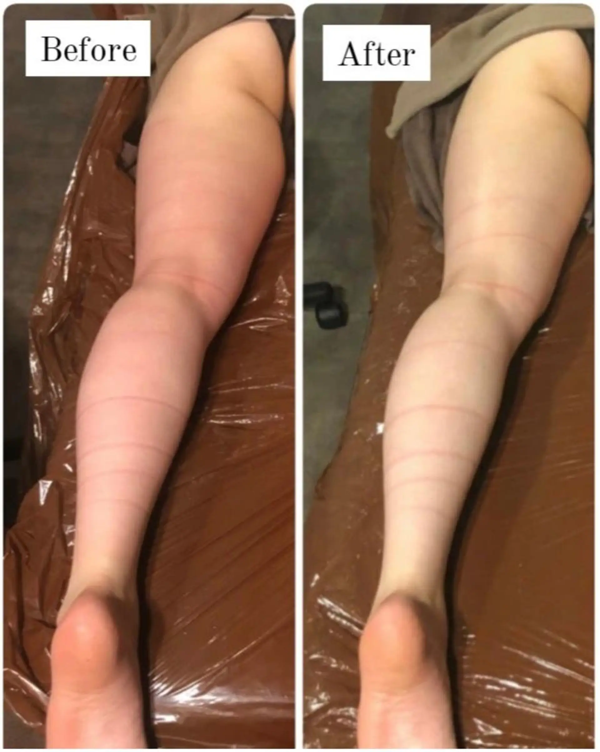 エステ Gemini 　MIKIのエステ・リラクイメージ