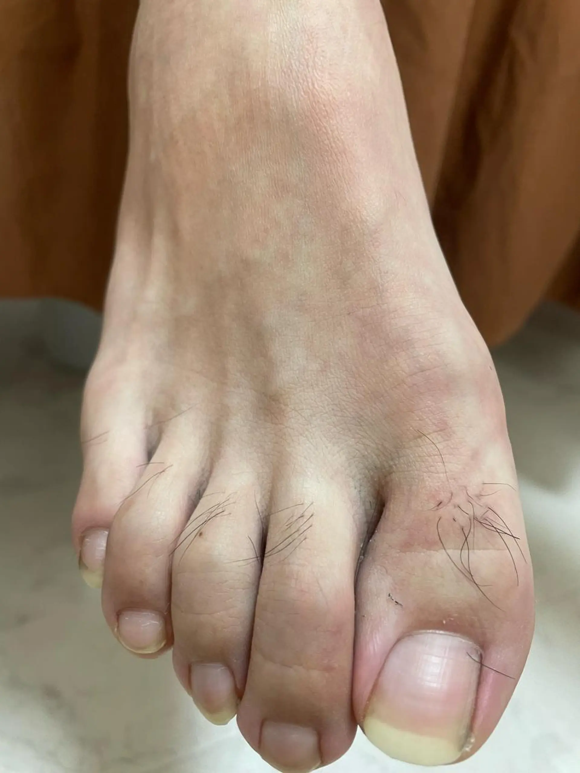 メンズ キッズ 脱毛SALON RaYNiCKのエステ・リラクイメージ