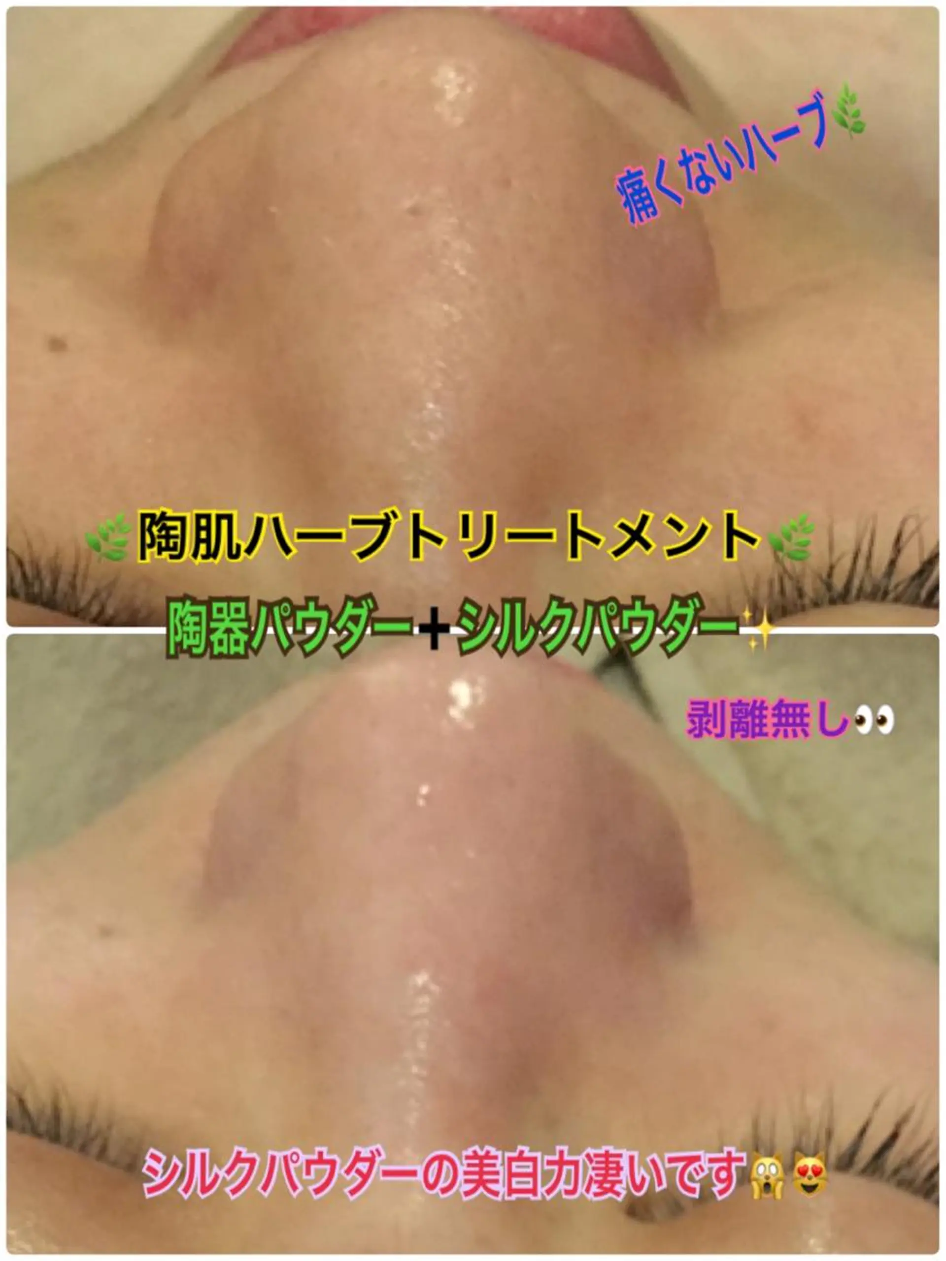 エステ 【リベルハーブピーリング認定店】敏感肌・美白脱毛専門店Dione立川店所属・Dione 立川店のエステ・リラクイメージ