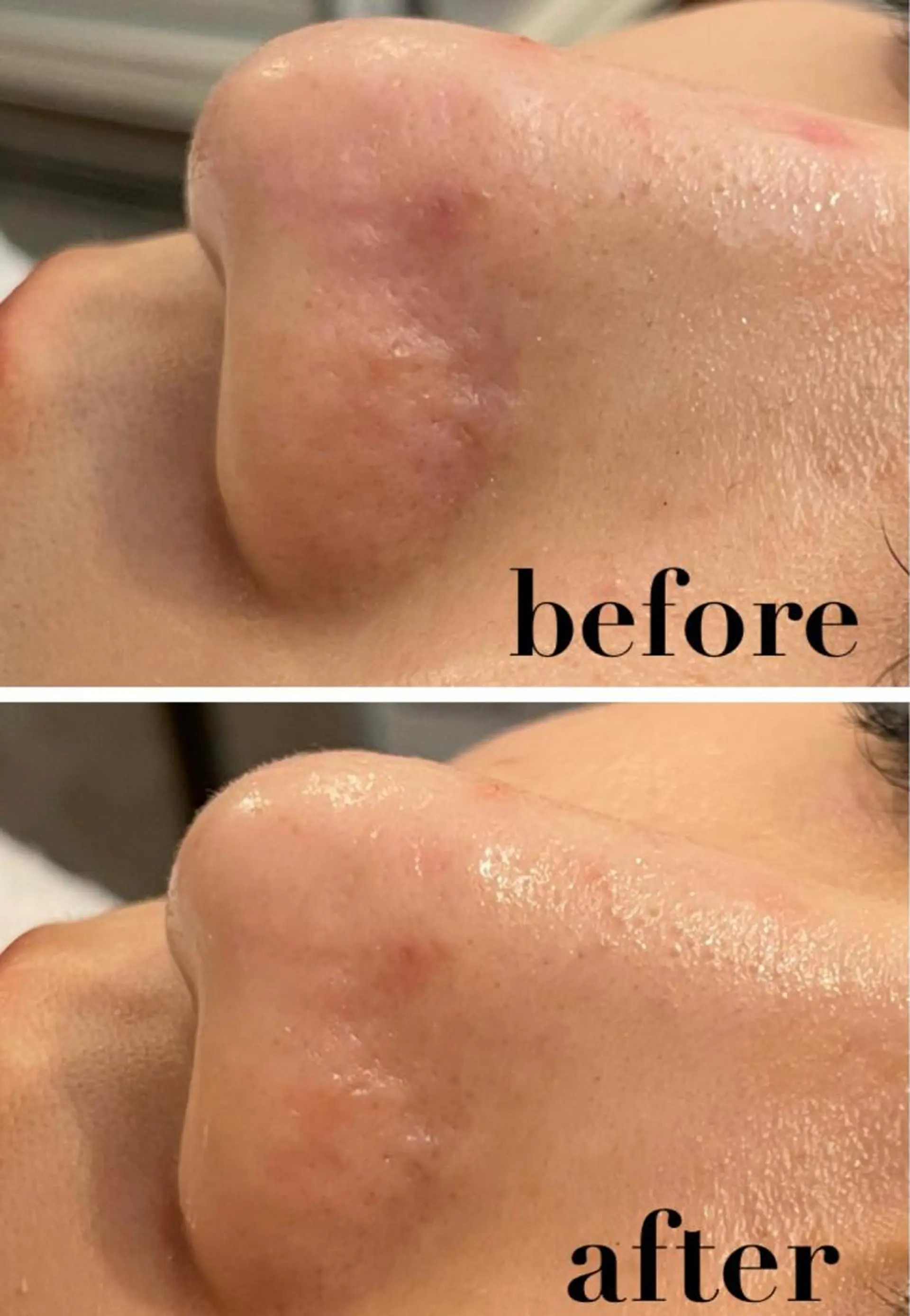 エステ 小林 玲菜のエステ・リラクイメージ