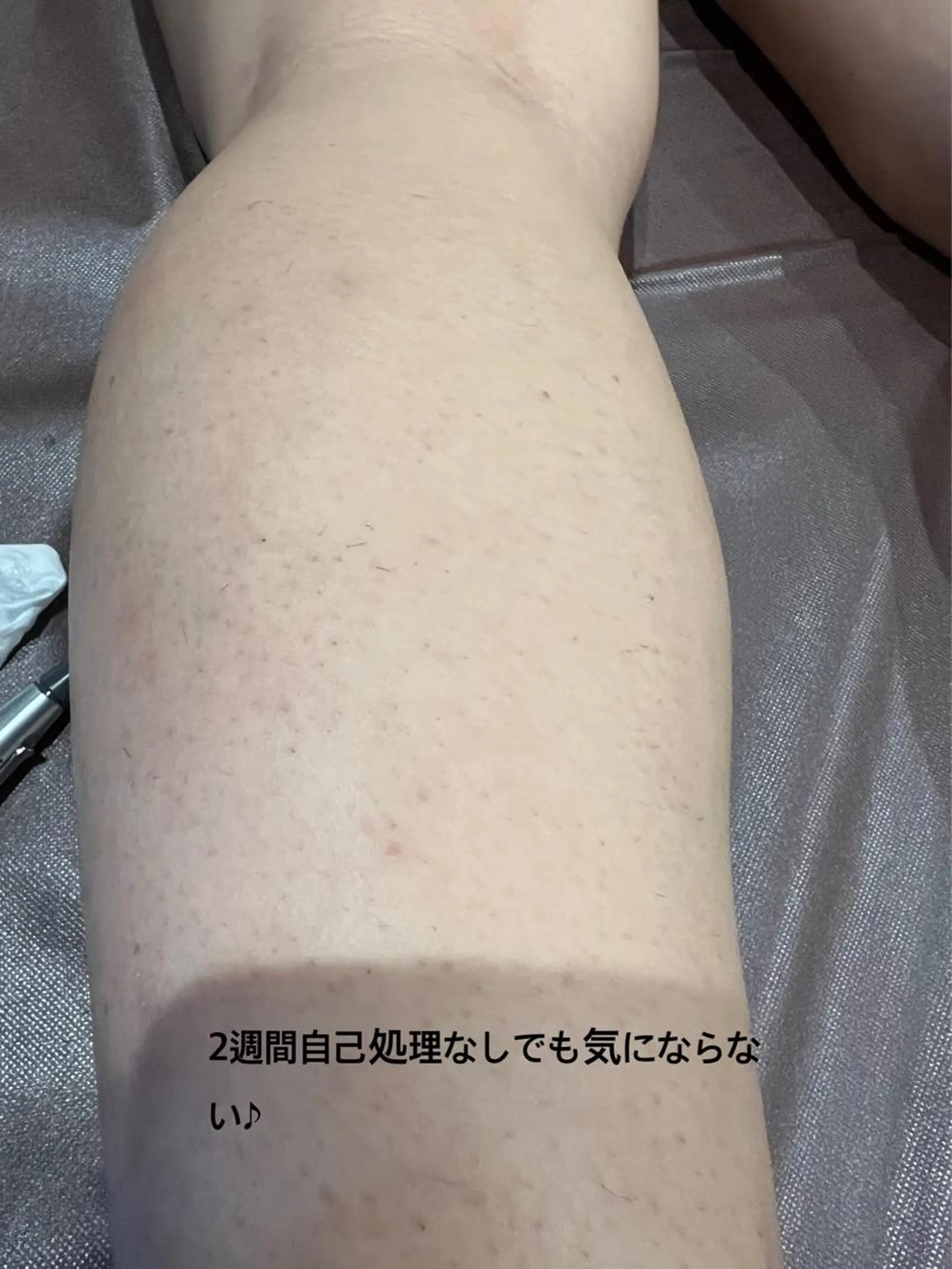 メンズ キッズ クラスペディア脱毛 ・フェイシャル専門店のエステ・リラクイメージ