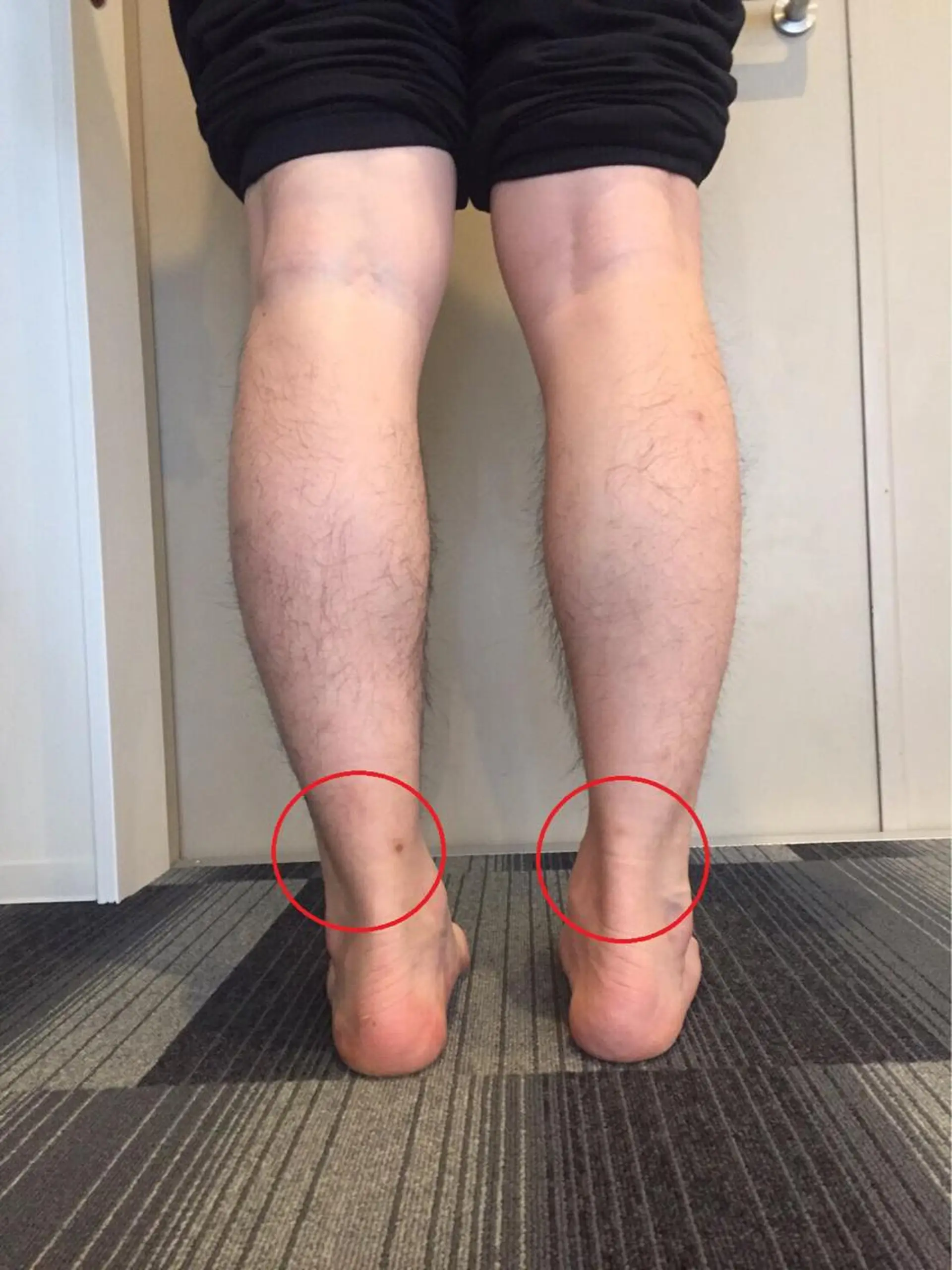 HappIness 遠赤外線ドームのエステ・リラクイメージ