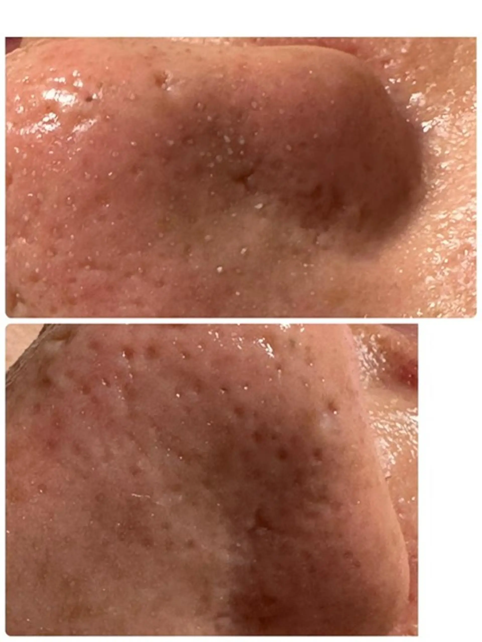 Lien オーナー　山口智嘉のエステ・リラクイメージ