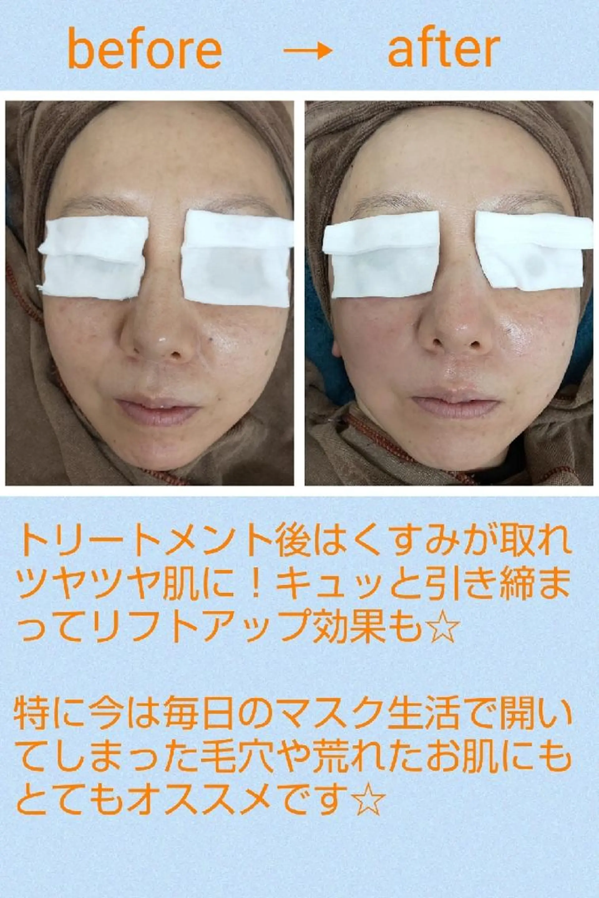 エステ 都度払いサロン BURIANのマツエク・マツパデザイン