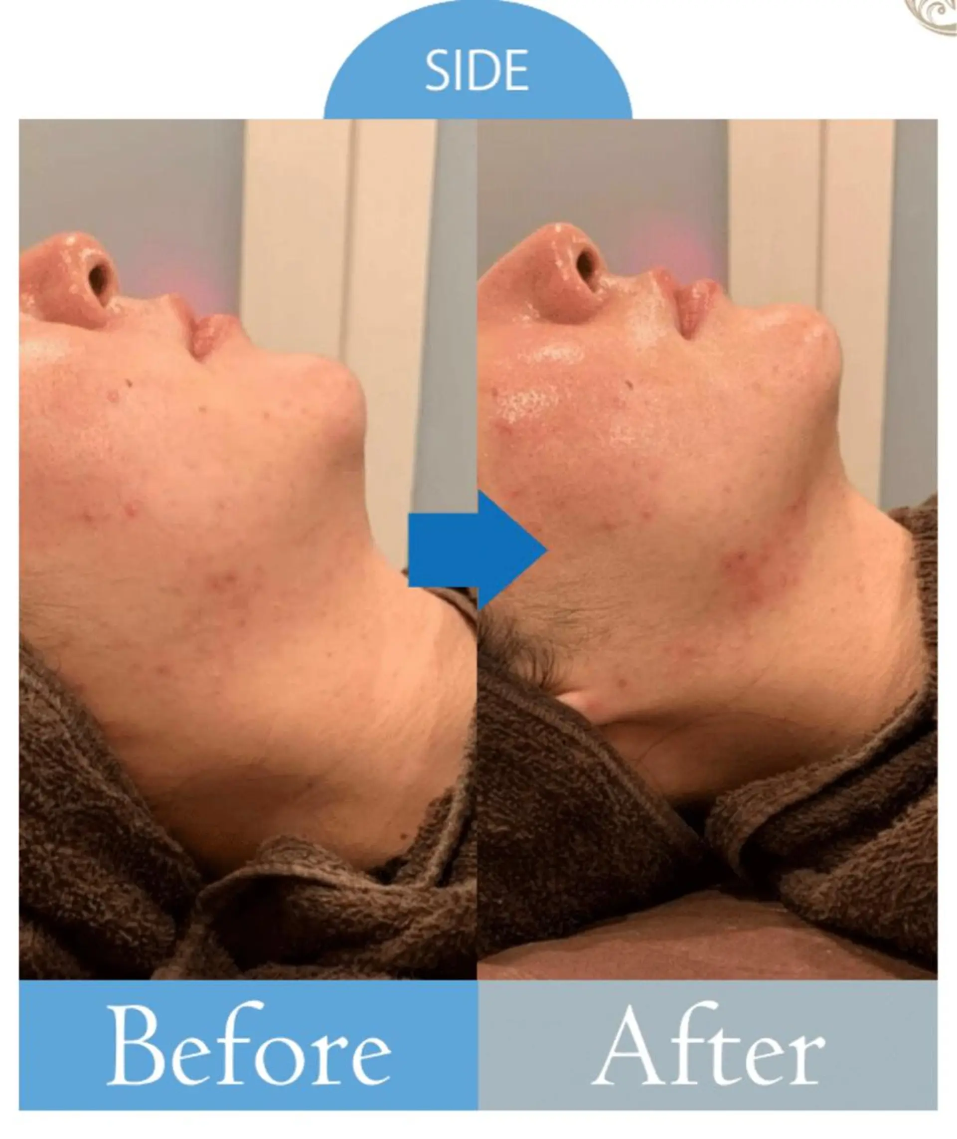 【医療提携エステ】 ルミナス北浦和のその他イメージ