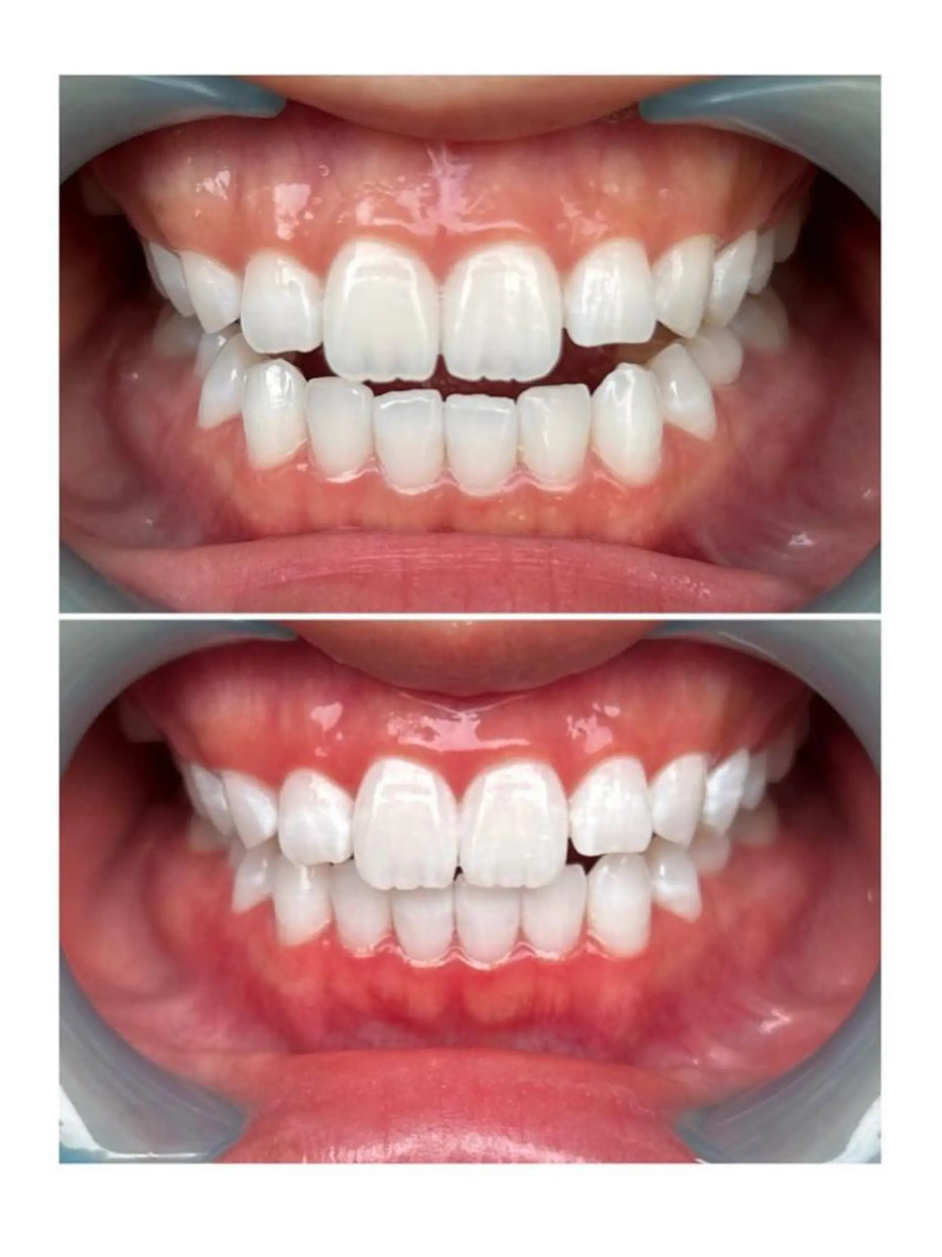 エステ ホワイトニングジム 池袋のその他イメージ