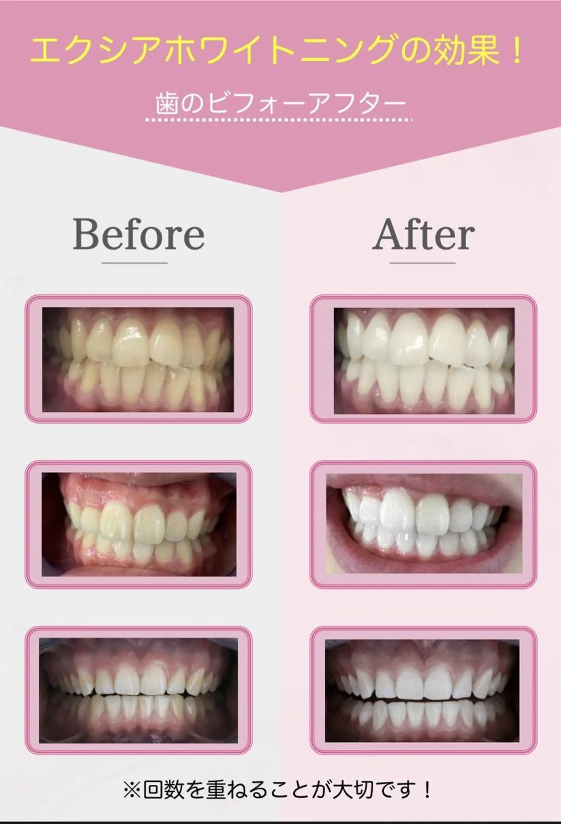 セルフホワイトニング エクシア大阪梅田店のその他イメージ