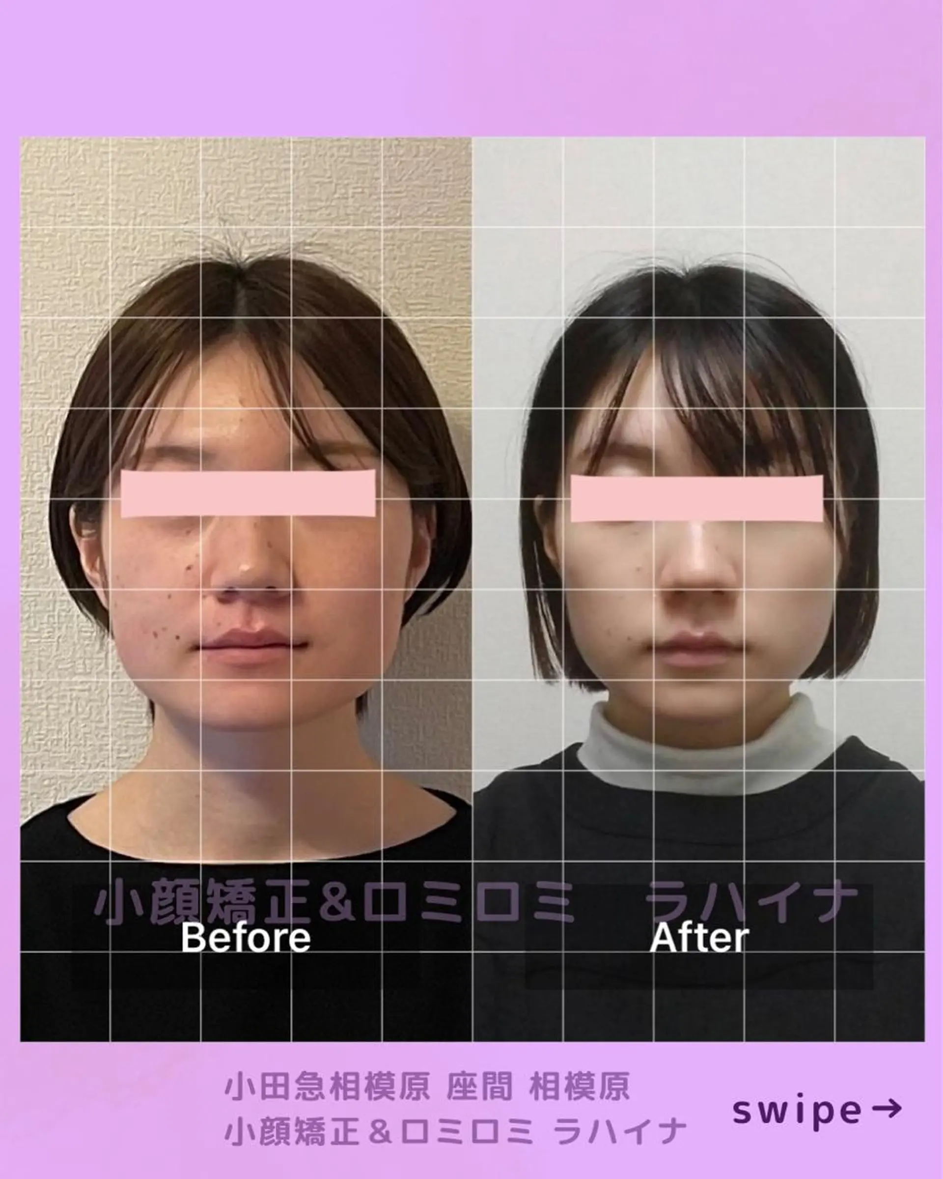 エステ 小顔矯正＆ロミロミ ラハイナ所属・小顔矯正 ラハイナのエステ・リラクイメージ